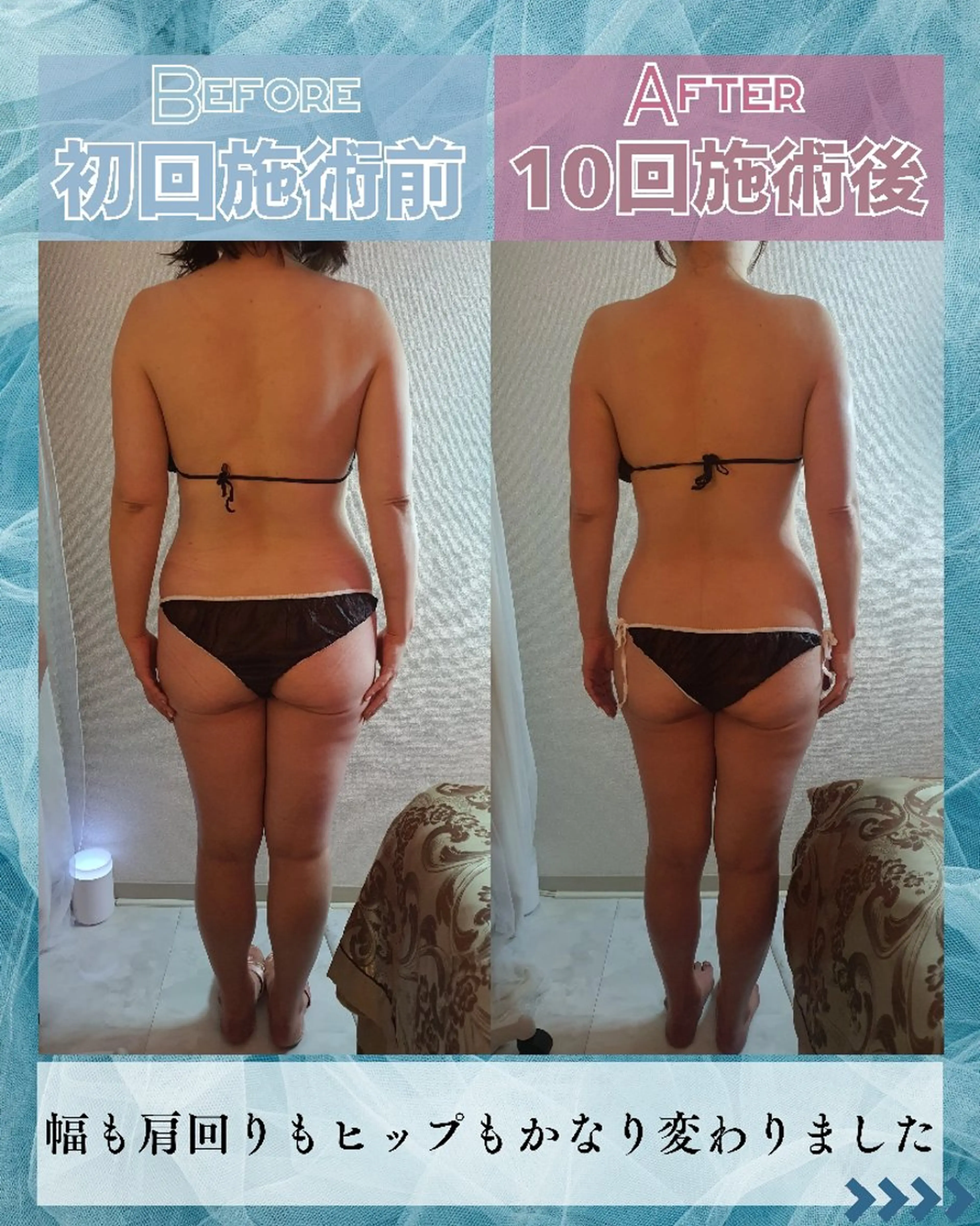 エステ リラク 痩身ハーブピーリング 筋膜リリース☆B&Hのエステ・リラクイメージ