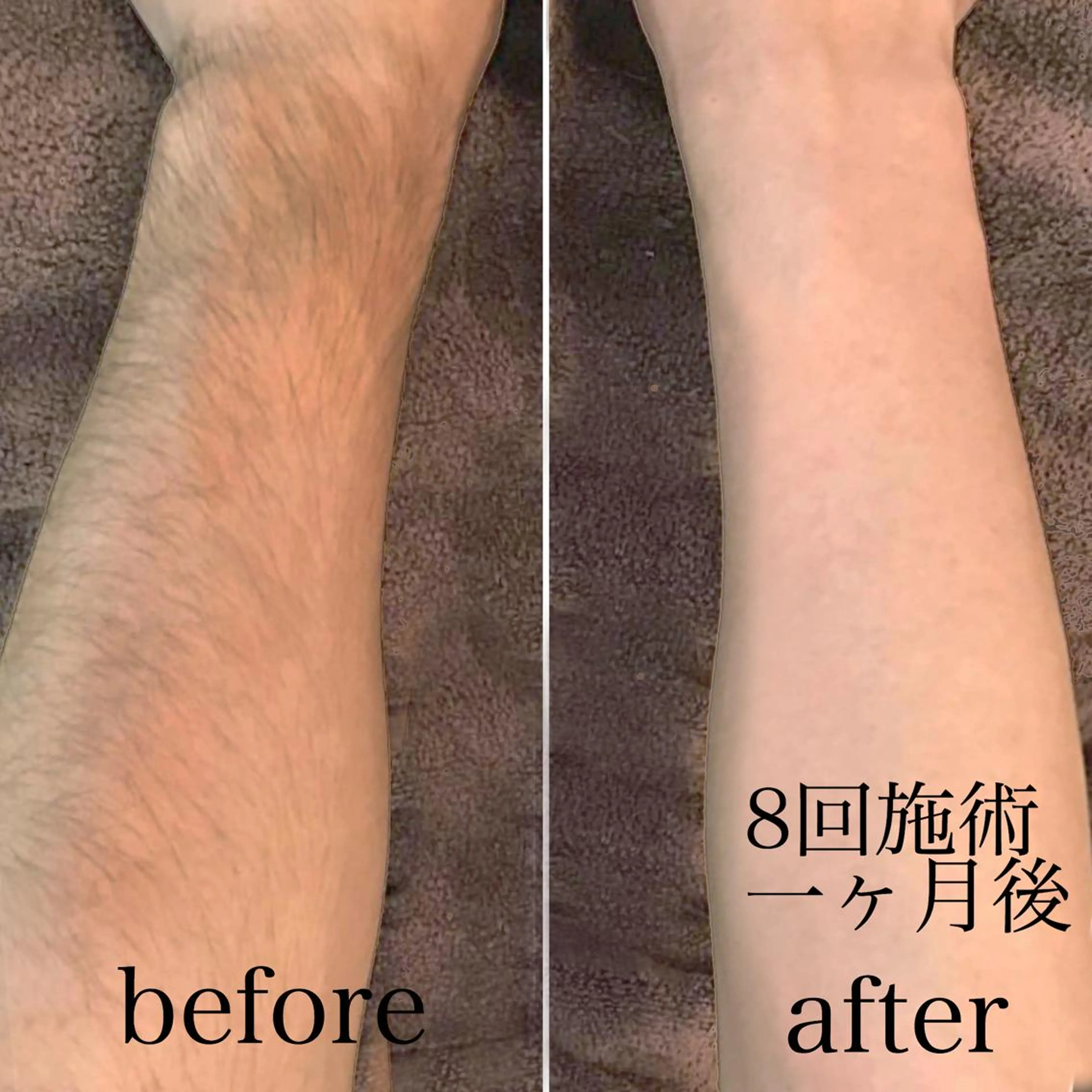 calon hair所属・men's calonのエステ・リラクイメージ