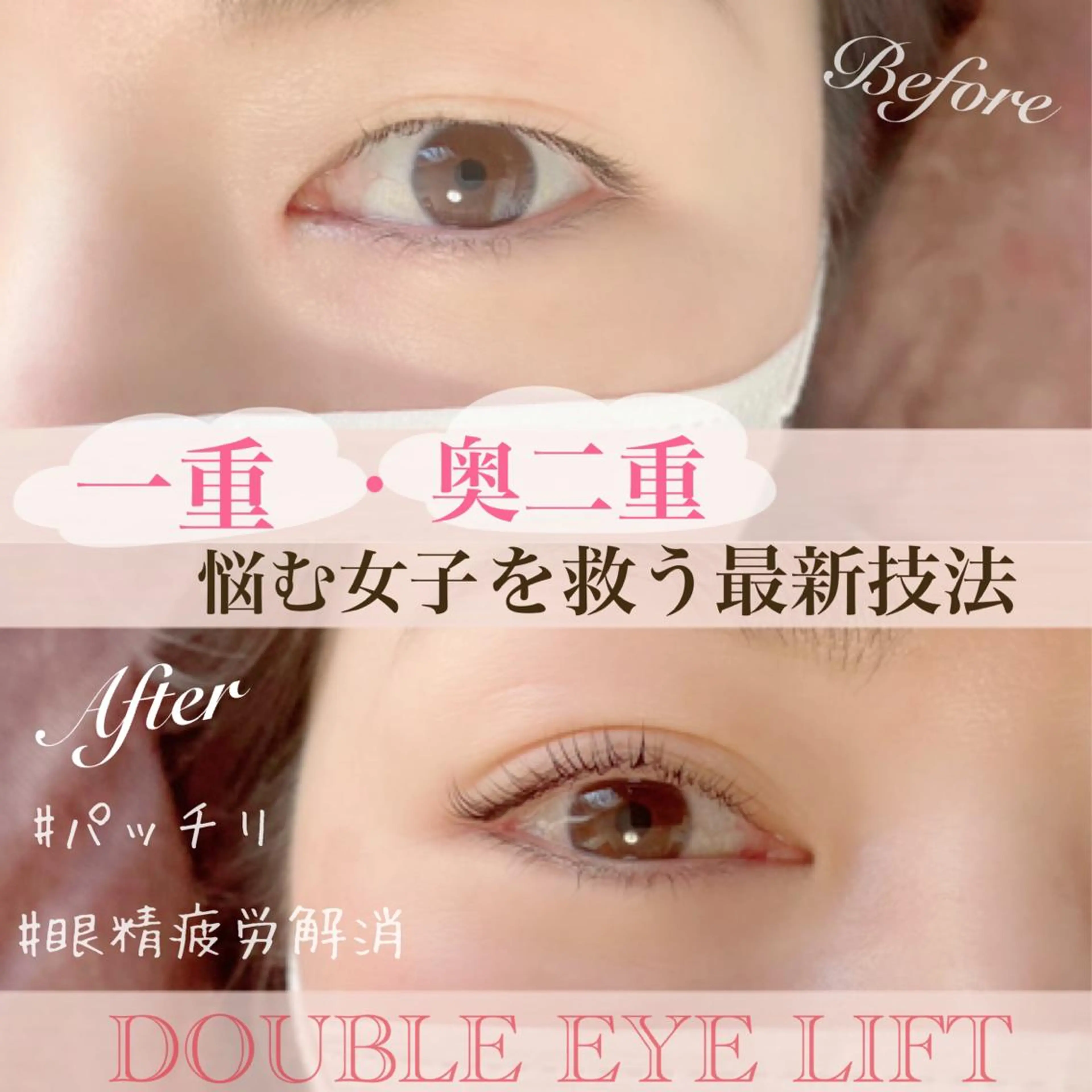 マツエク・マツパ 一重×まつ毛パーマ マツパ LOKA-HULU  ロカフルのマツエク・マツパデザイン