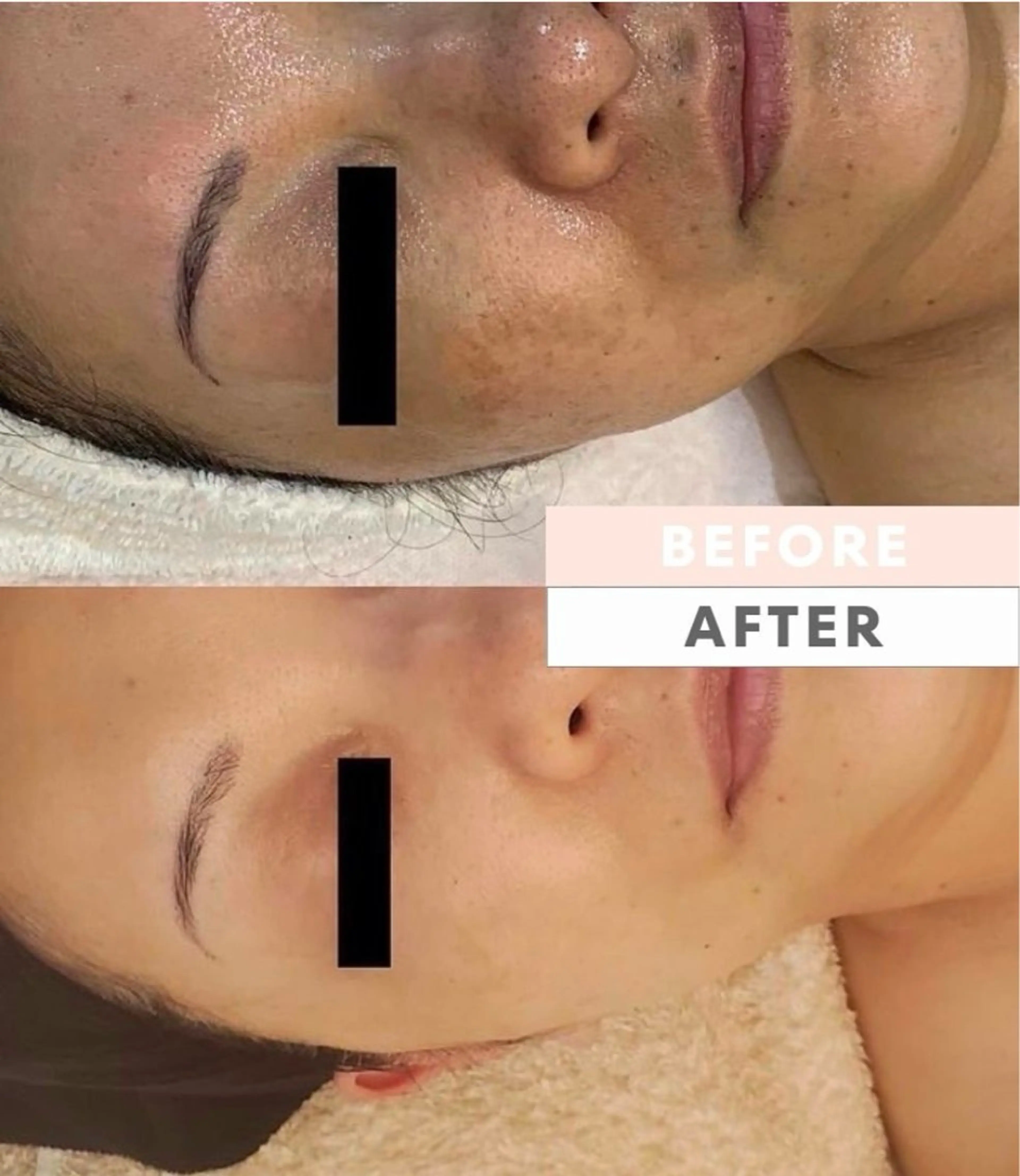 水光韓国肌ハーブ ピーリングMplusのエステ・リラクイメージ