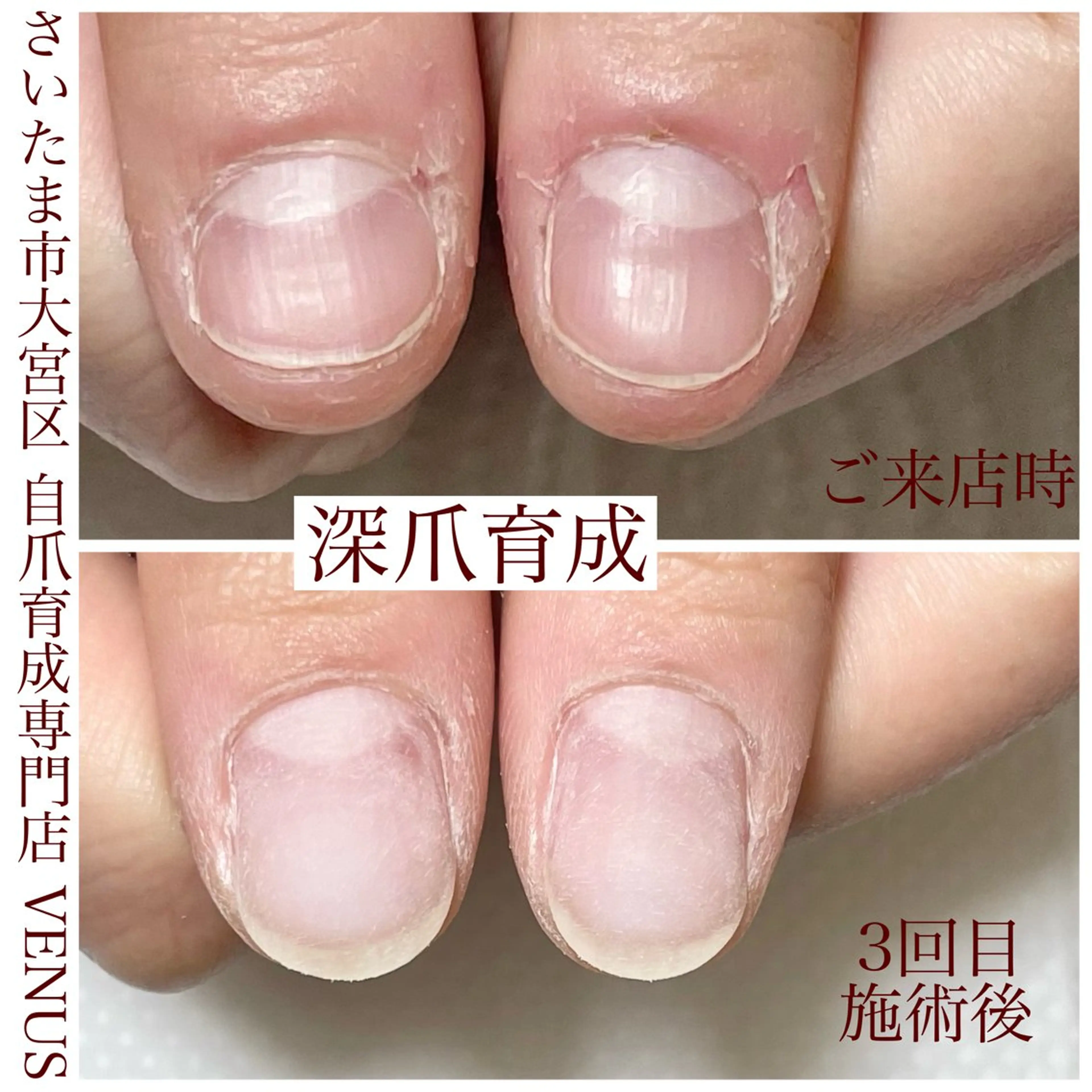 ネイル ハンドネイル ハンドケア nailsalon VENUSのネイルデザイン