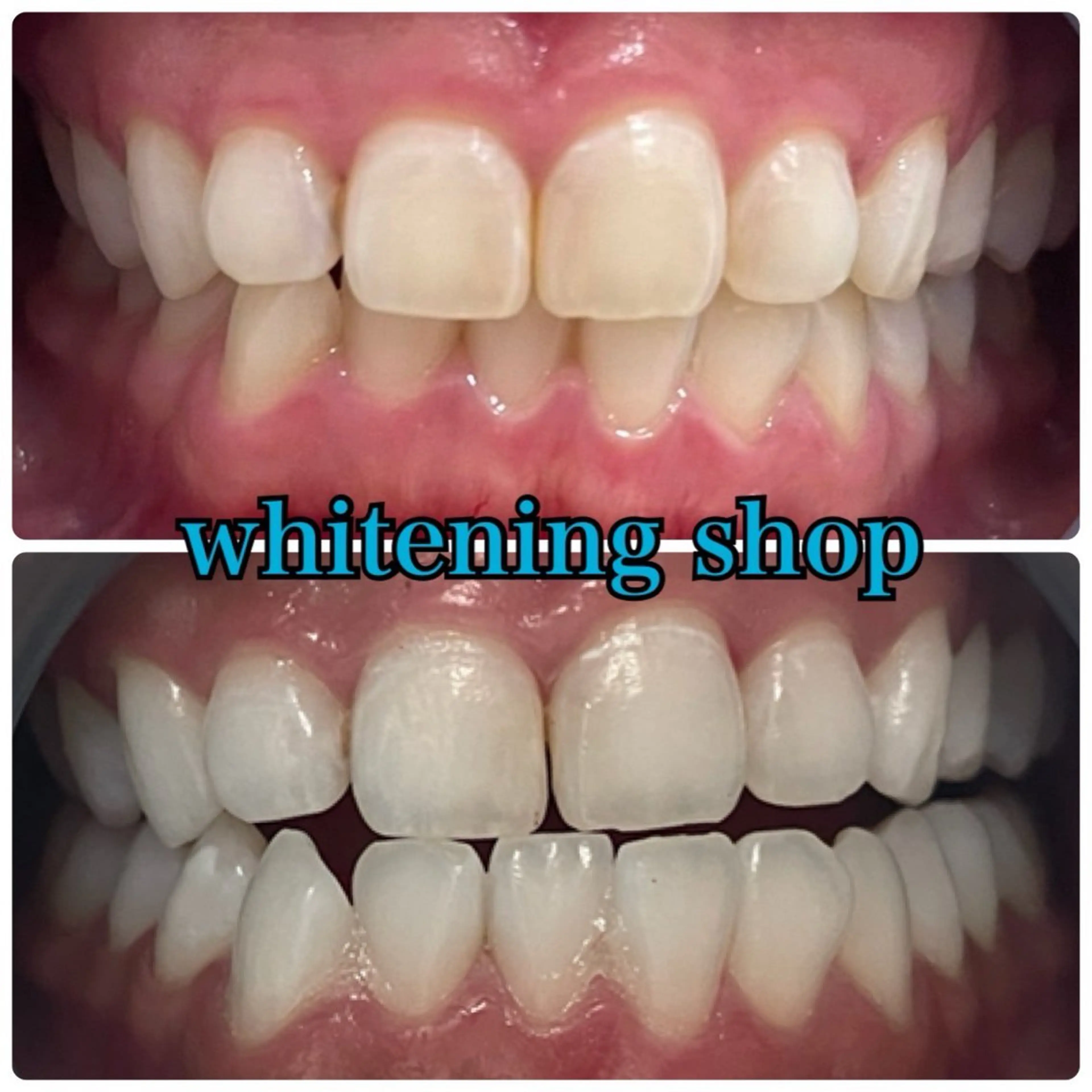 メンズ エステ リラク ホワイトニング ショップ川越店のエステ・リラクイメージ