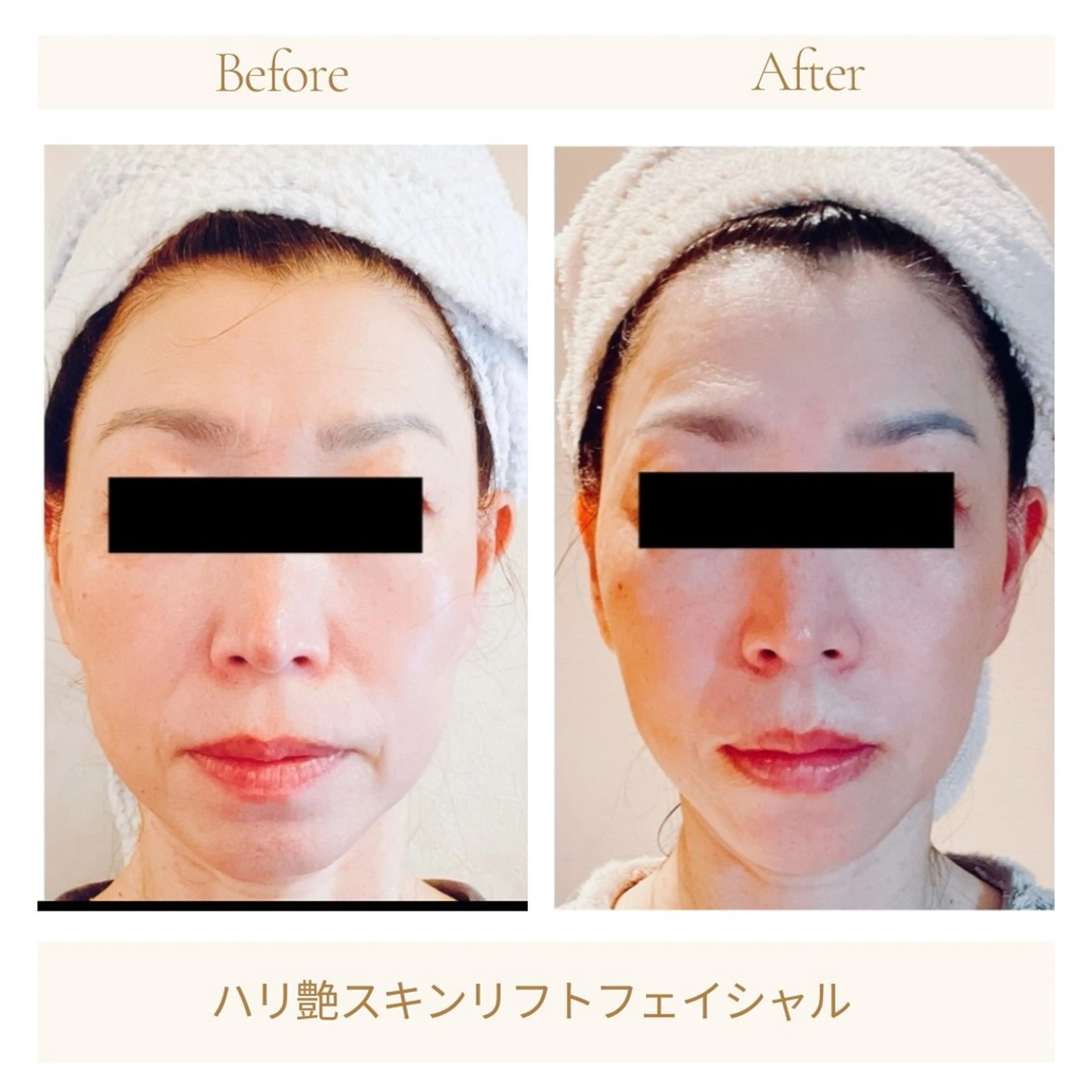 エステ 小顔・デトックスリンパ専門サロンRadiant Muse (ラディアントミューズ)所属・小顔・たるみ改善 ラディアントミューズのエステ・リラクイメージ