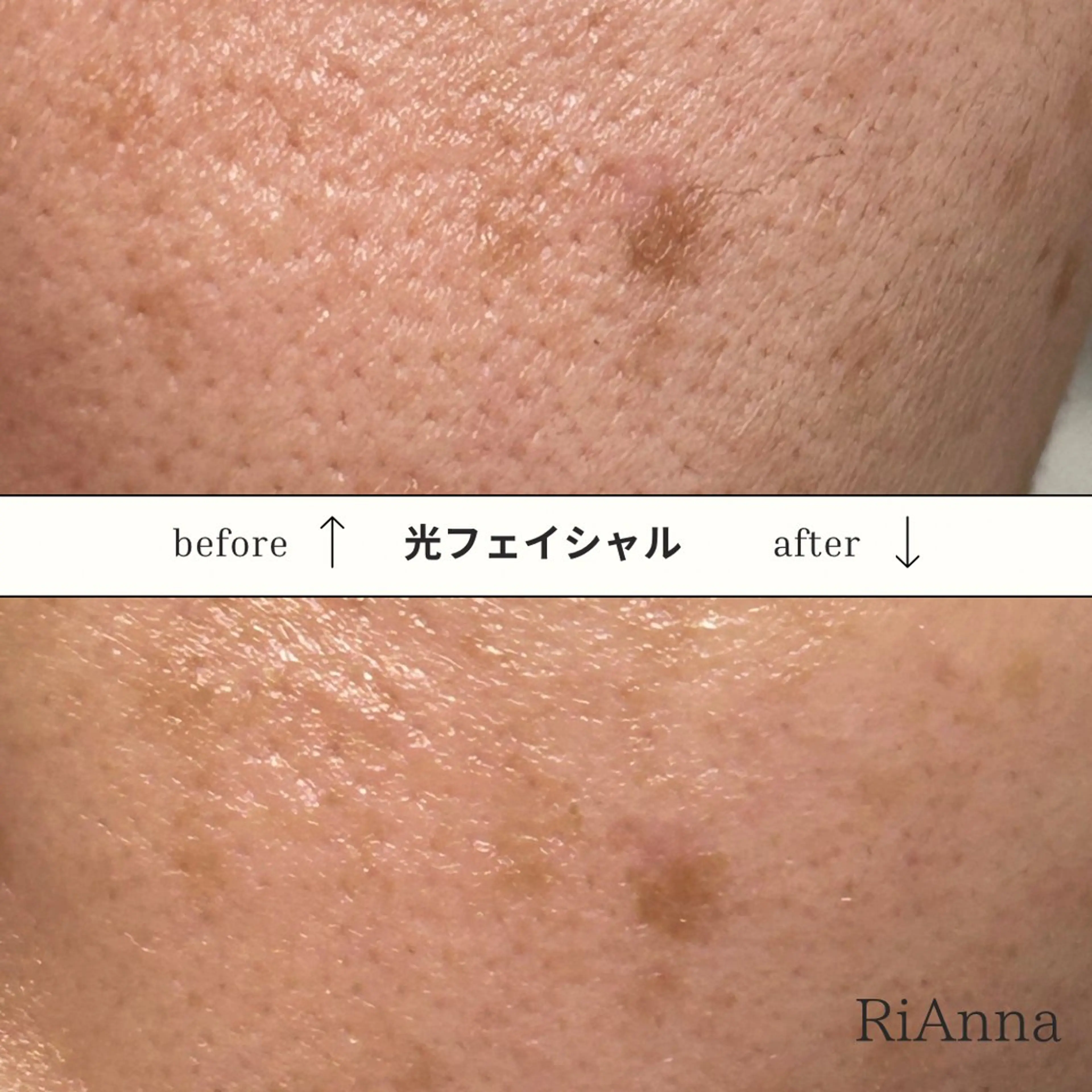 RuxuryNail ／RiAnnaのネイルデザイン