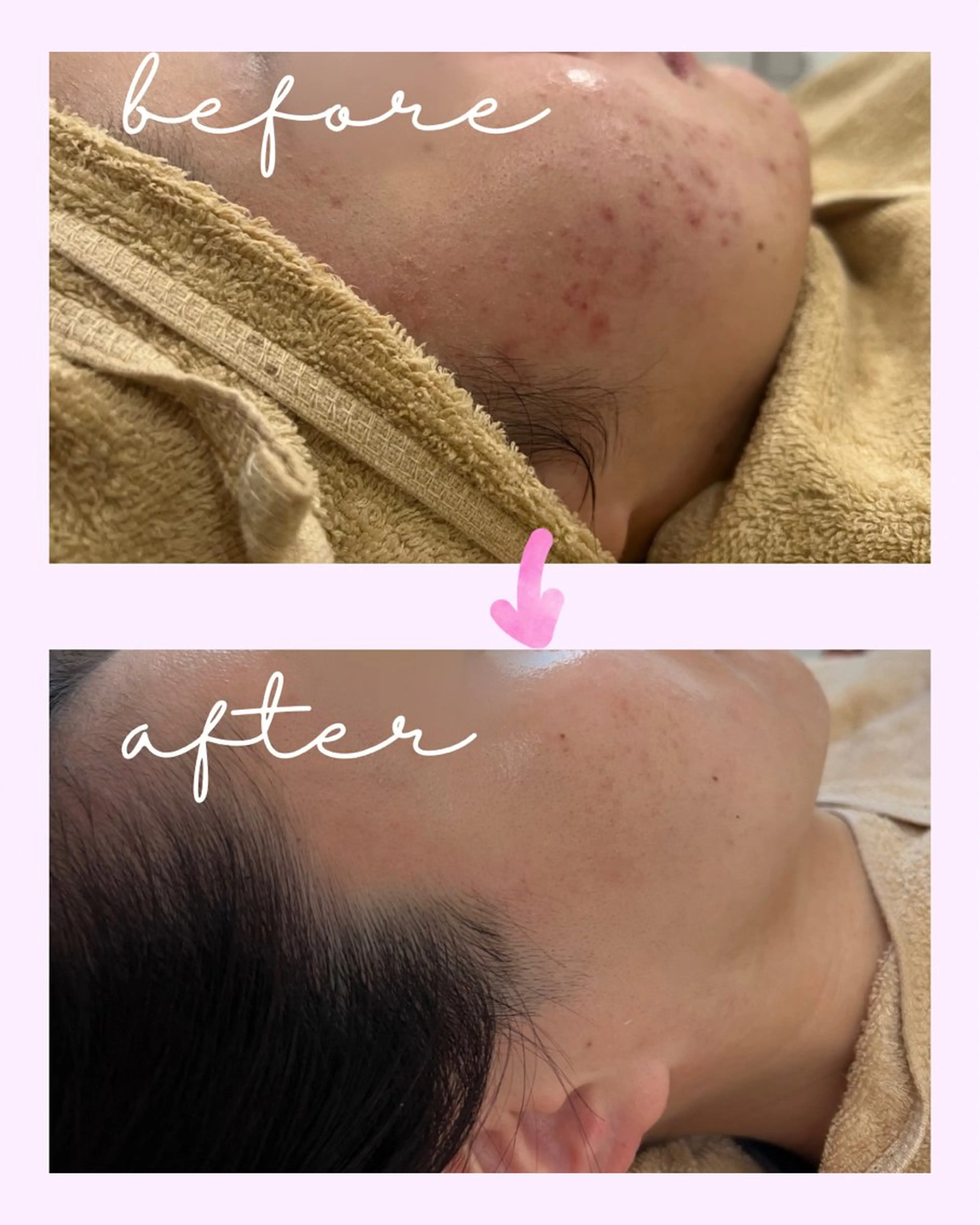 エステ ｍｉkｉ 東根の肌質改善サロンのエステ・リラクイメージ