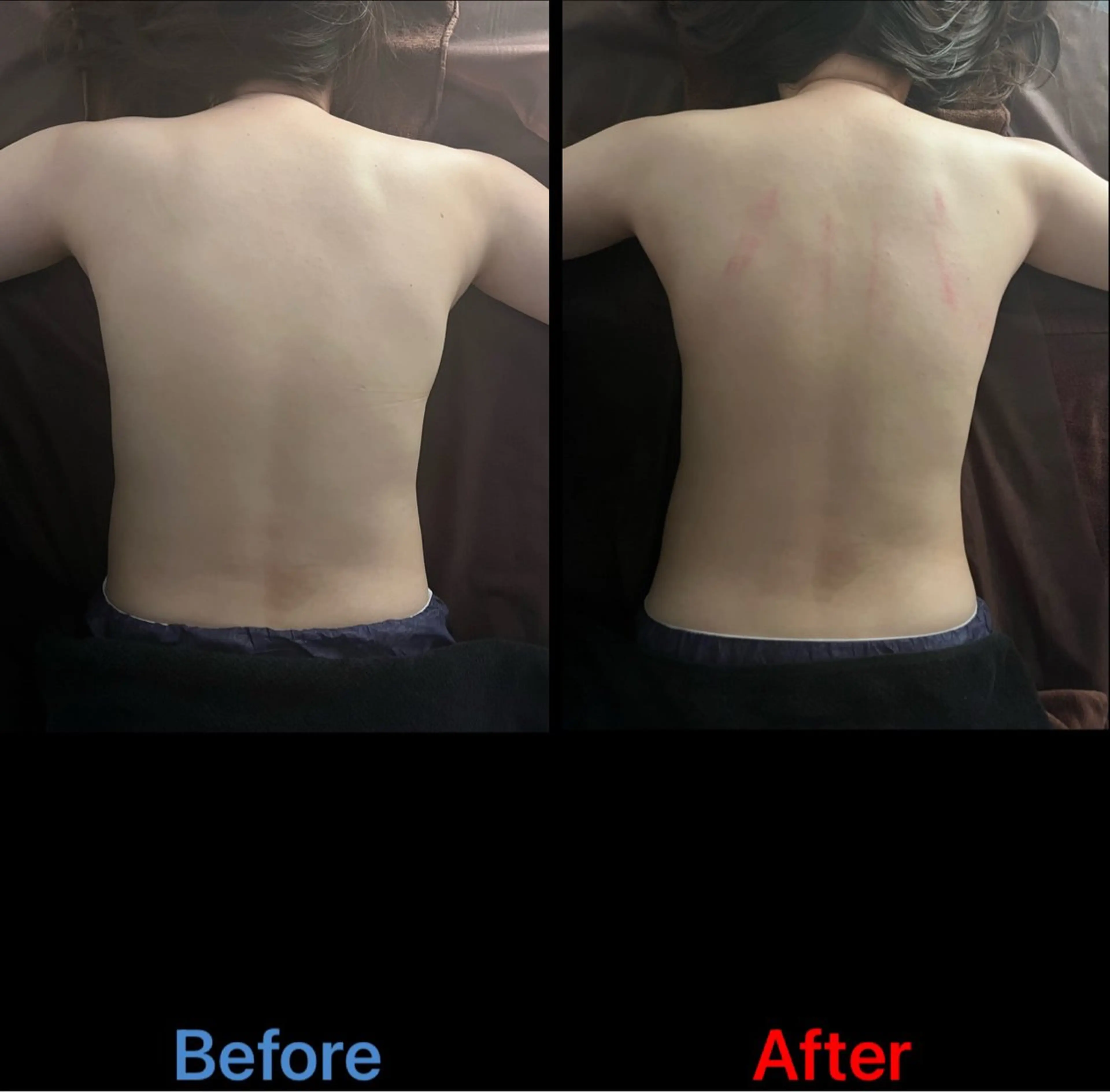 引き締め&整える！全身＋お腹痩せ、骨盤矯正80分コースの写真