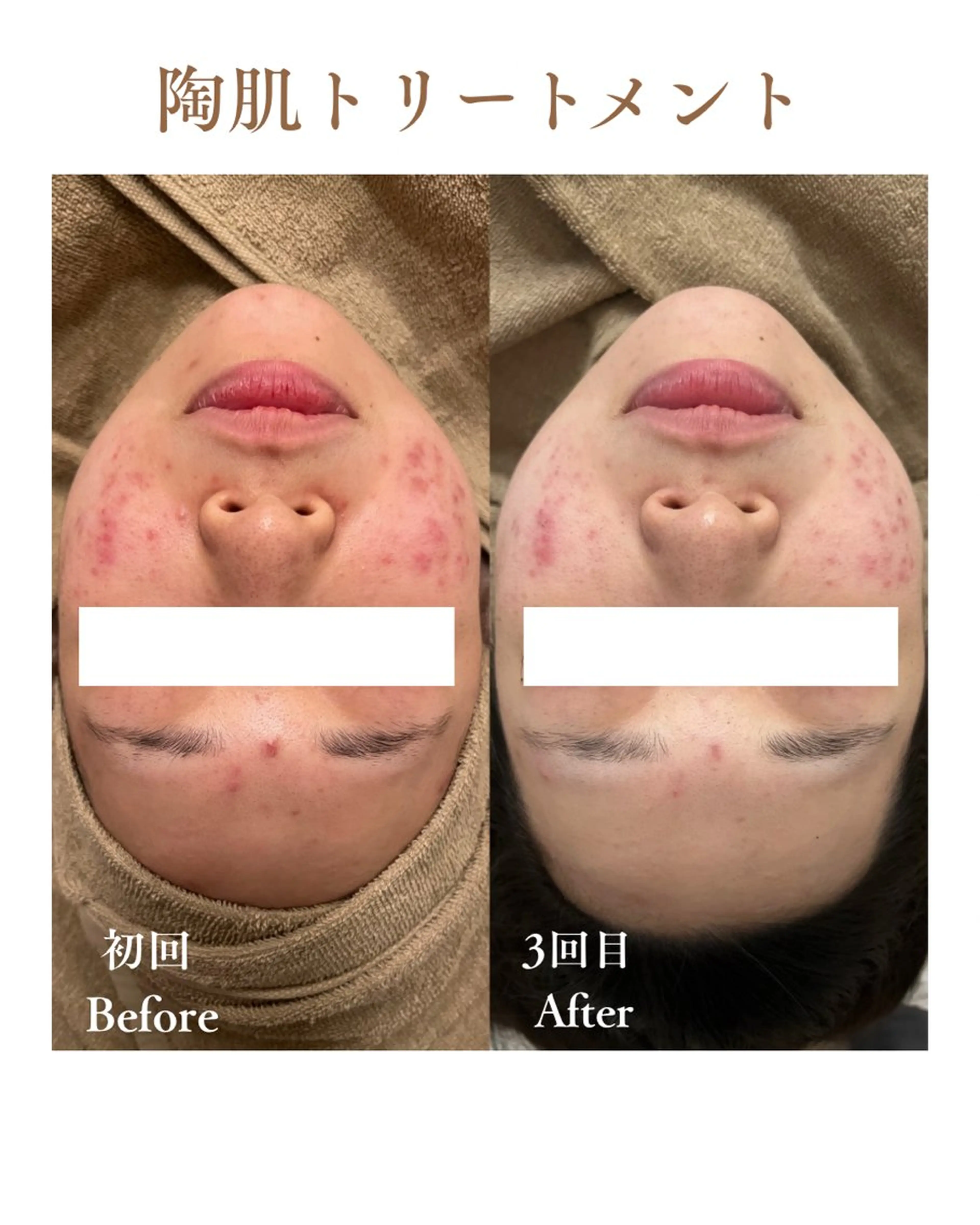 エステ 肌質改善専門サロン Lusisのエステ・リラクイメージ