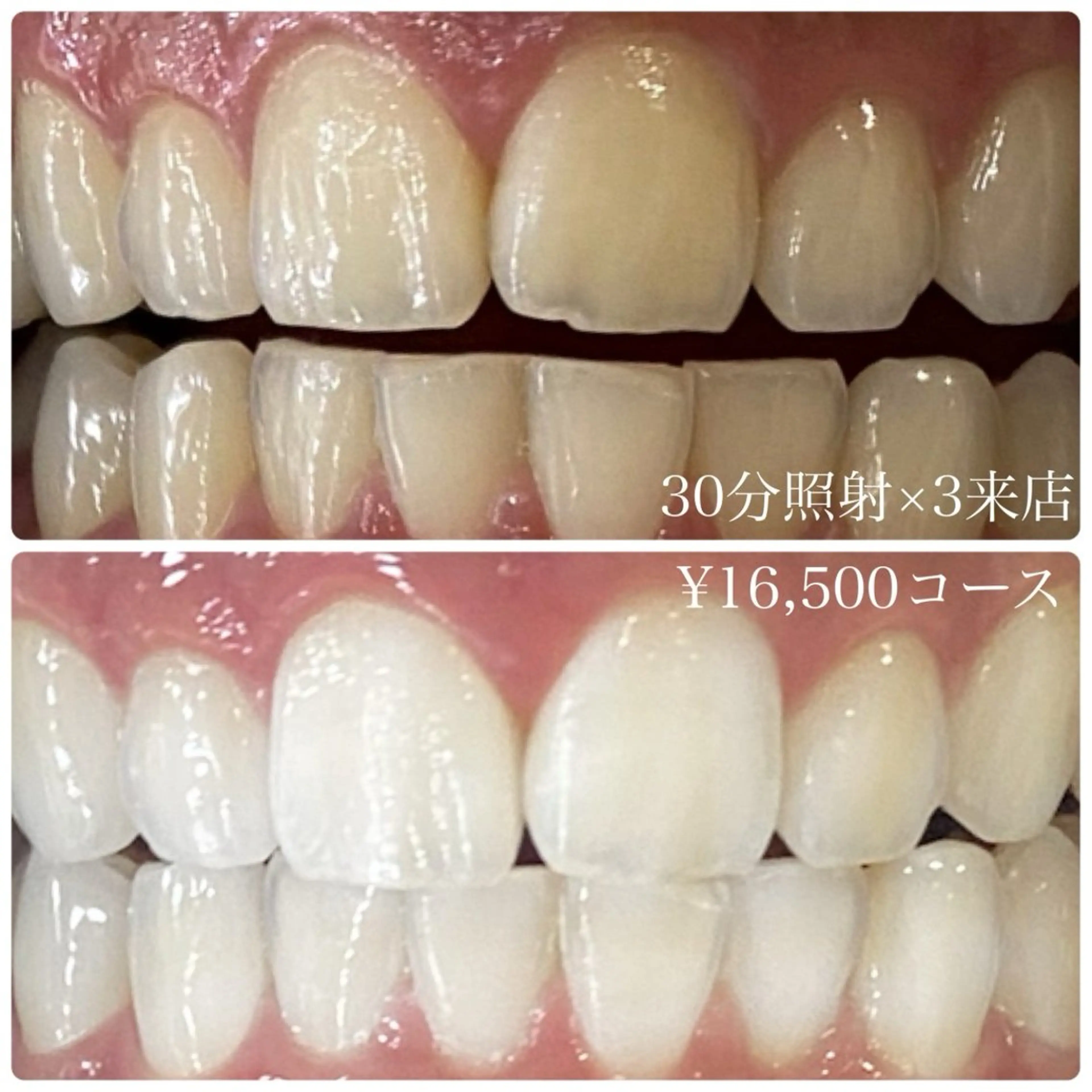 PLATINUM Beauty 横浜店所属・ホワイトニングルーム 横浜店のその他イメージ