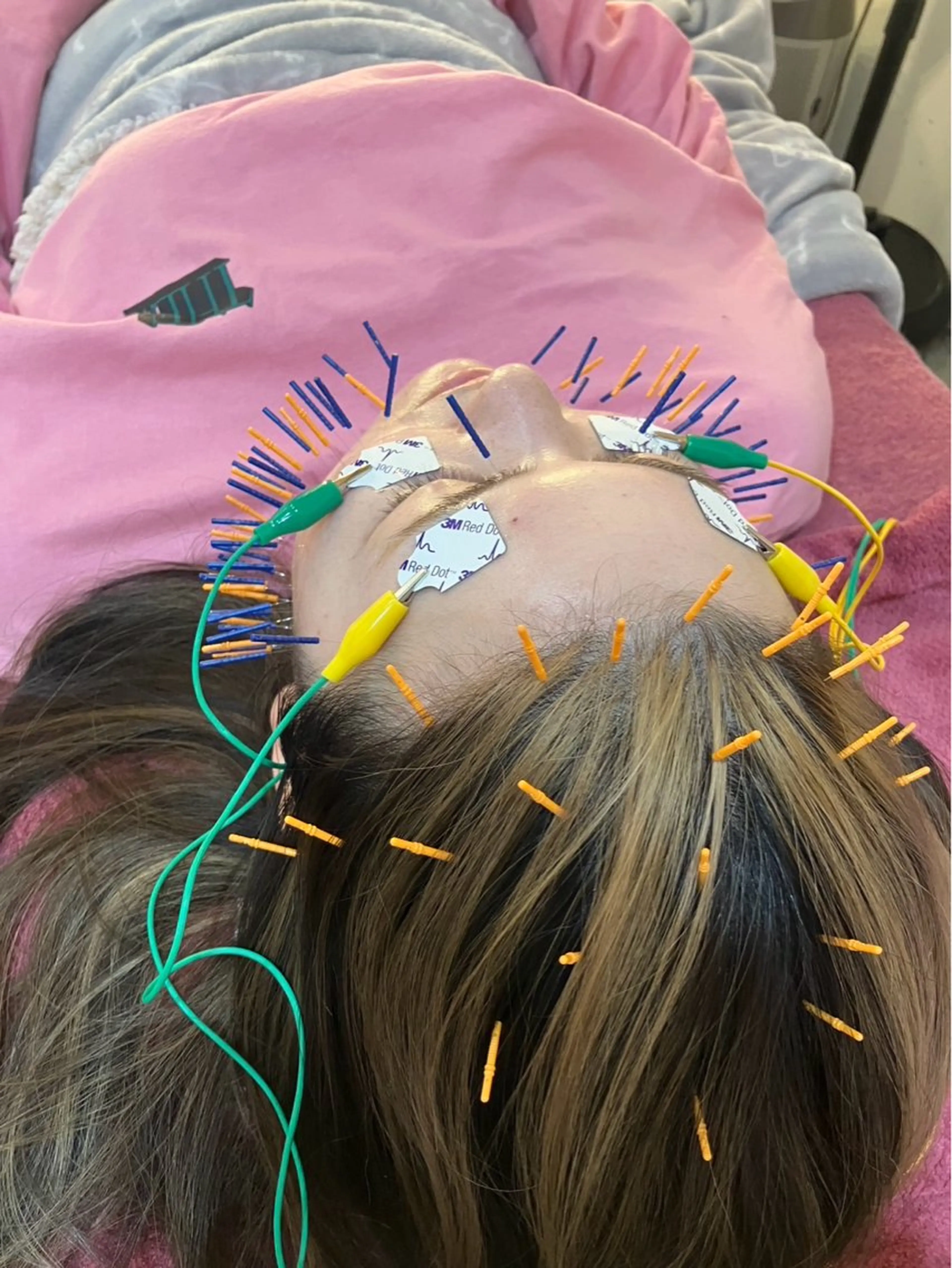 🌸５Ｋ対策🌸【小顔、肩こり、クマ、くすみ、花粉症乾燥肌】小顔スペシャルコース‼️の写真