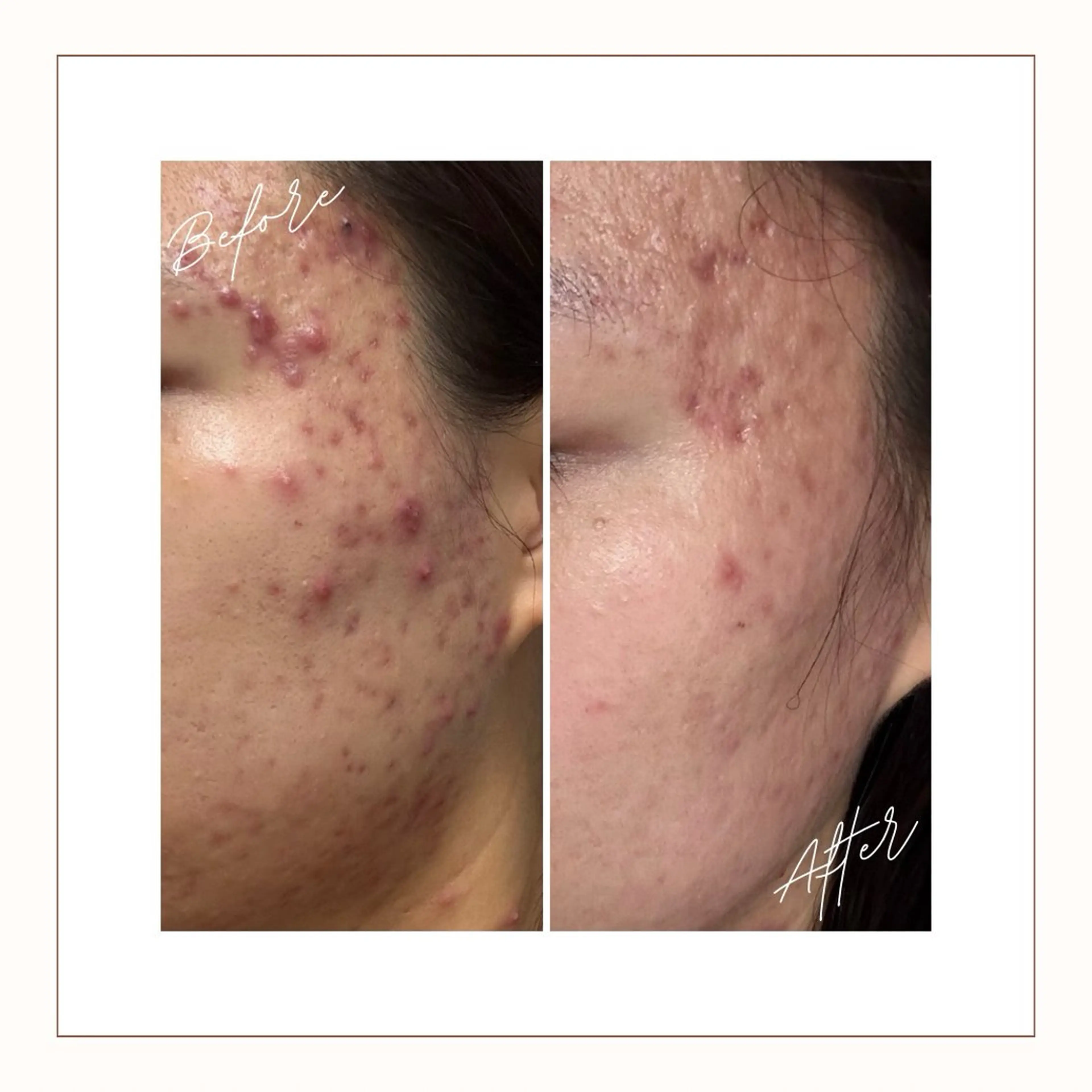 エステ Toujours トゥジュールのエステ・リラクイメージ