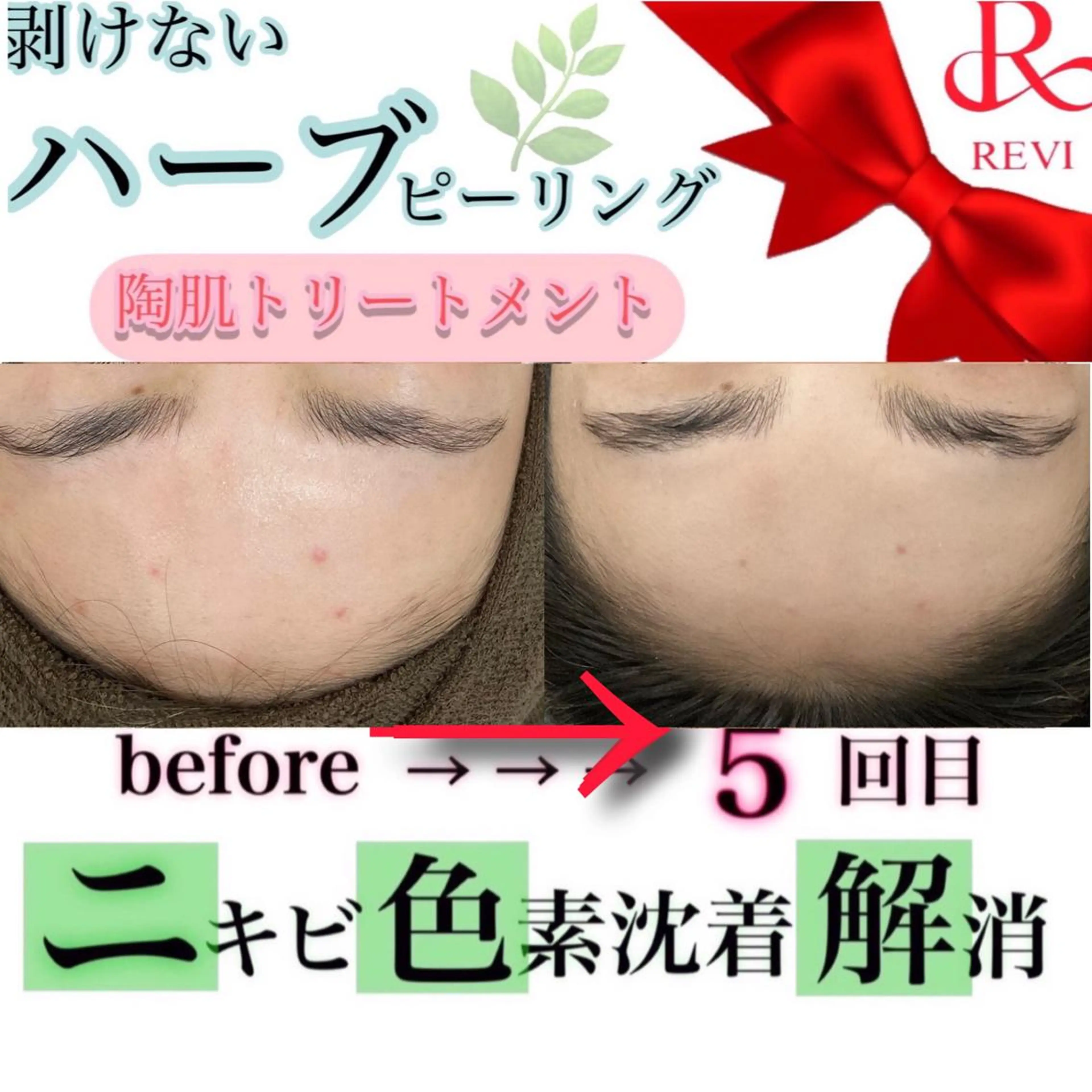 laluna saki...のその他イメージ