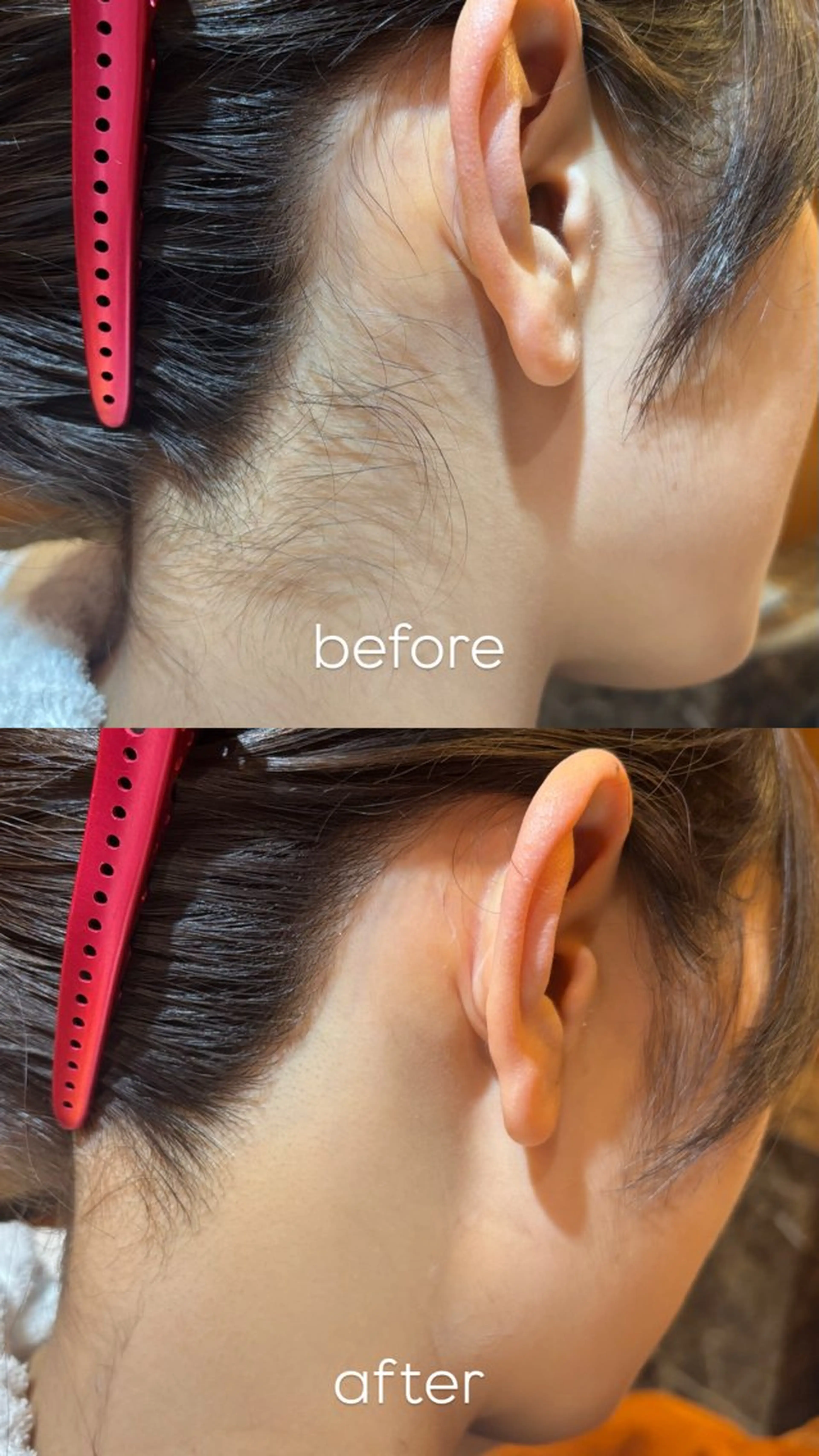 脱毛 佐藤 真帆のエステ・リラクイメージ