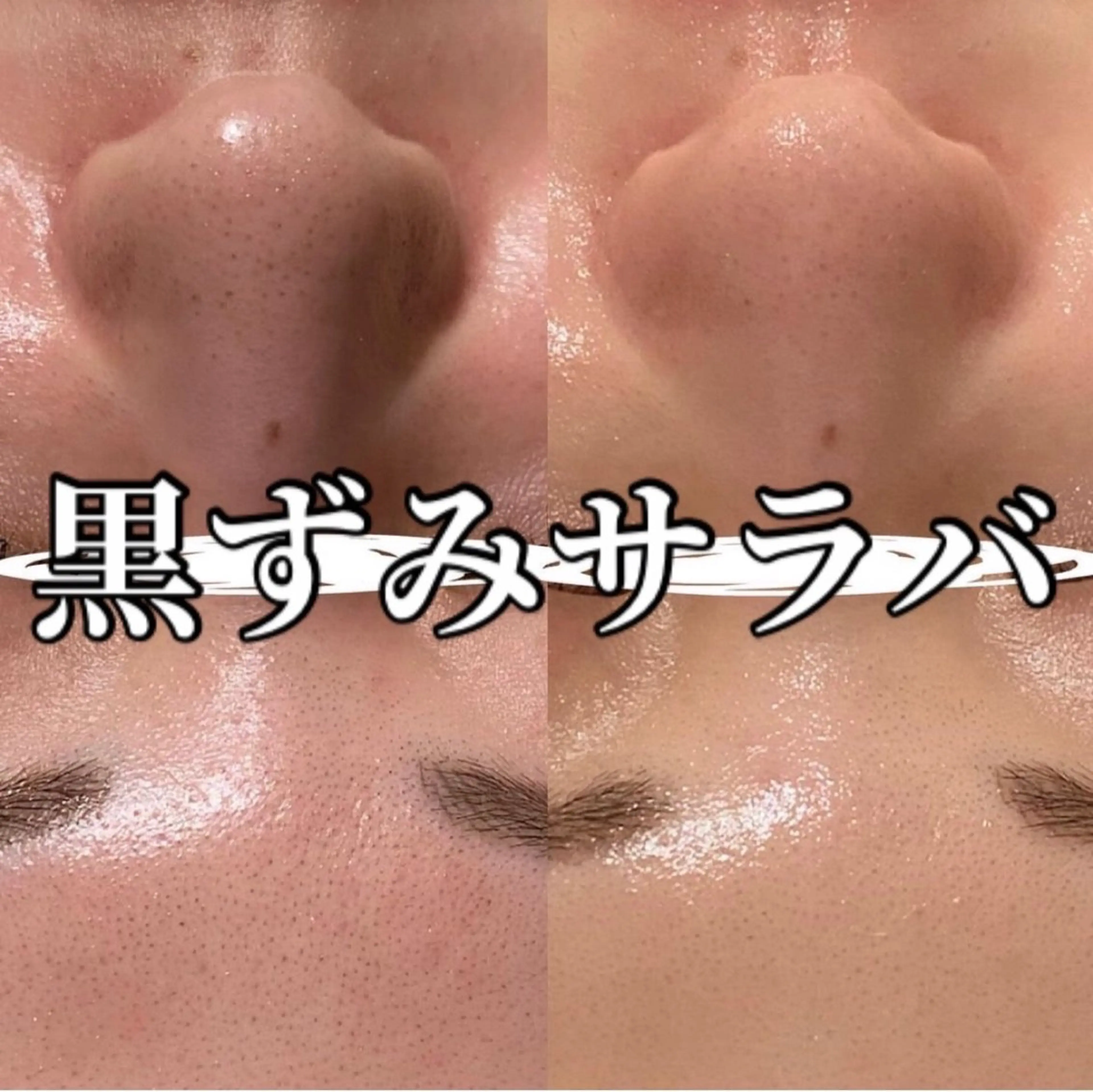 中目黒ハーブピーリン グ🌿ララピールのエステ・リラクイメージ