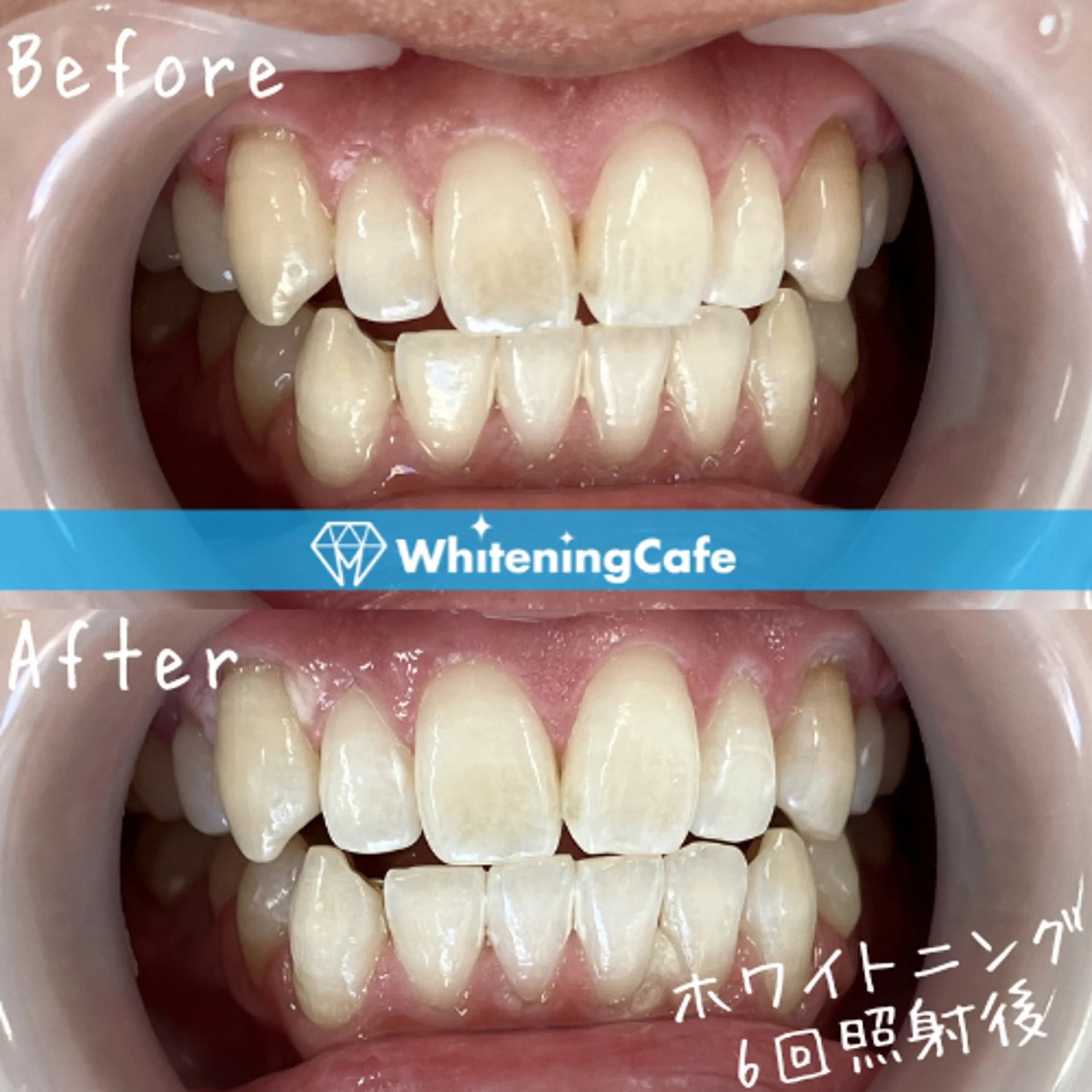 ホワイトニングカフェ徳島沖浜店所属・ホワイトニングカフェ 徳島沖浜店のエステ・リラクイメージ