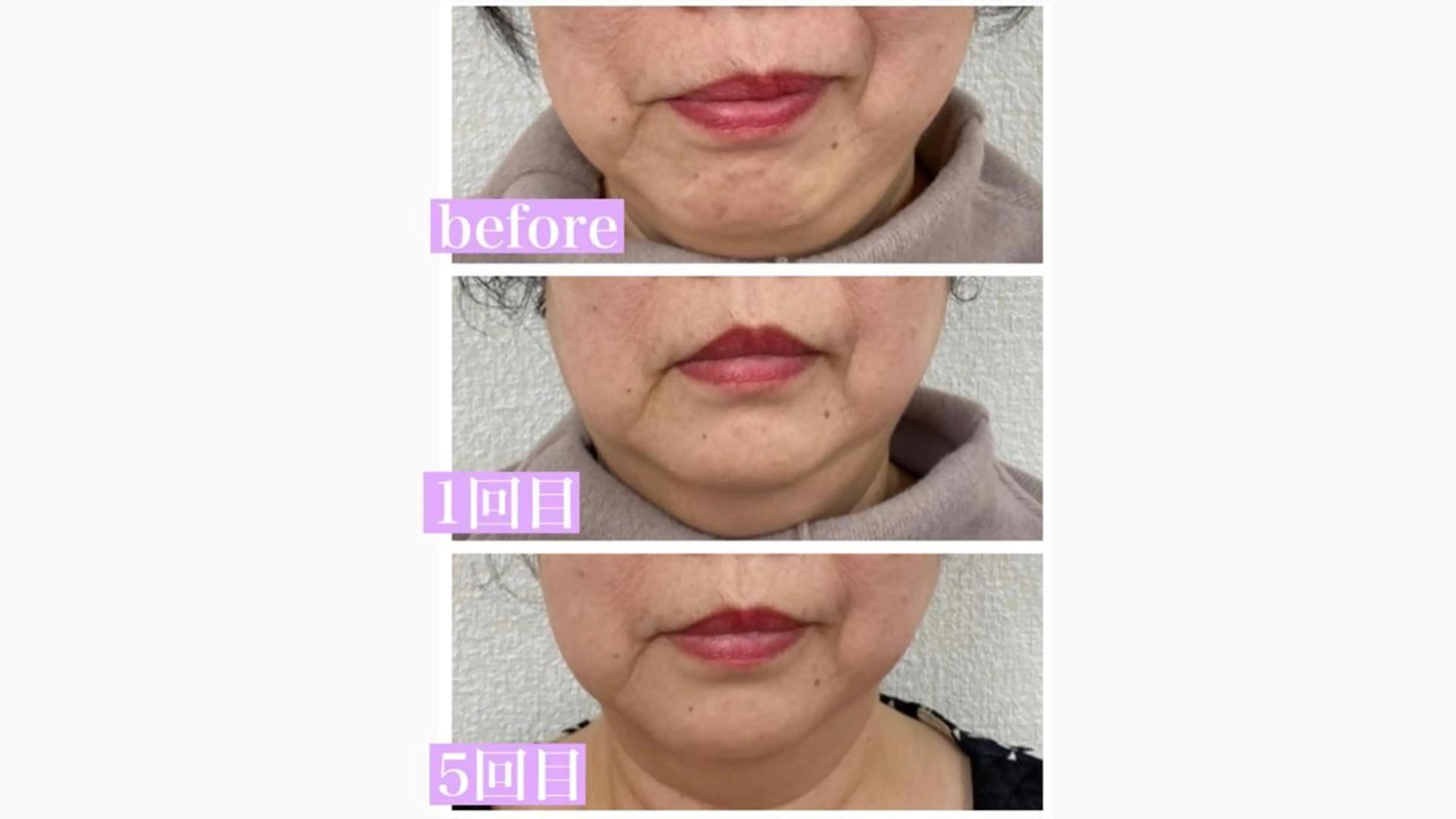 小顔矯正サロン Lilyのエステ・リラクイメージ