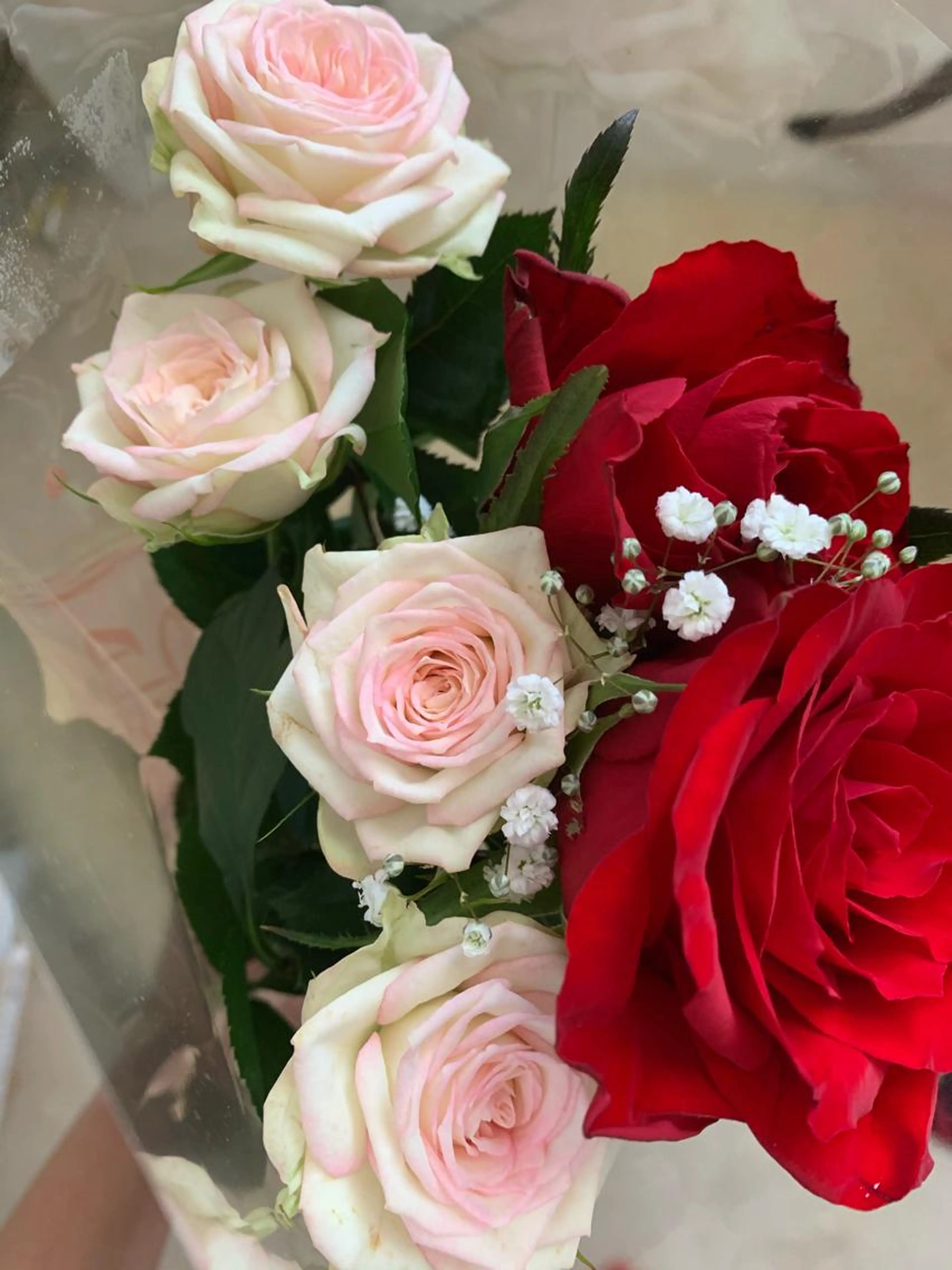 【学生限定】　VIO ワックス脱毛の写真