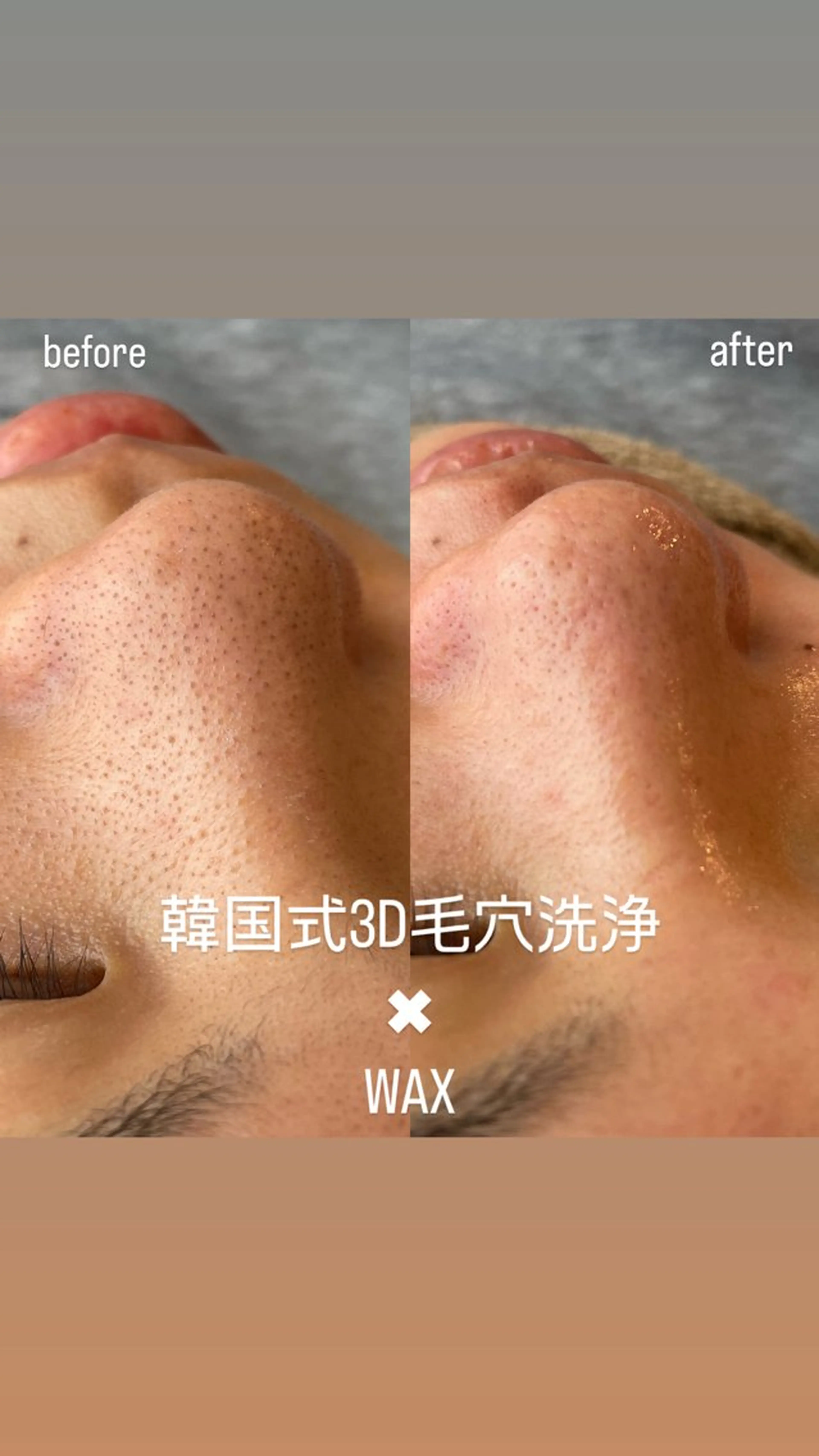 New __のその他イメージ