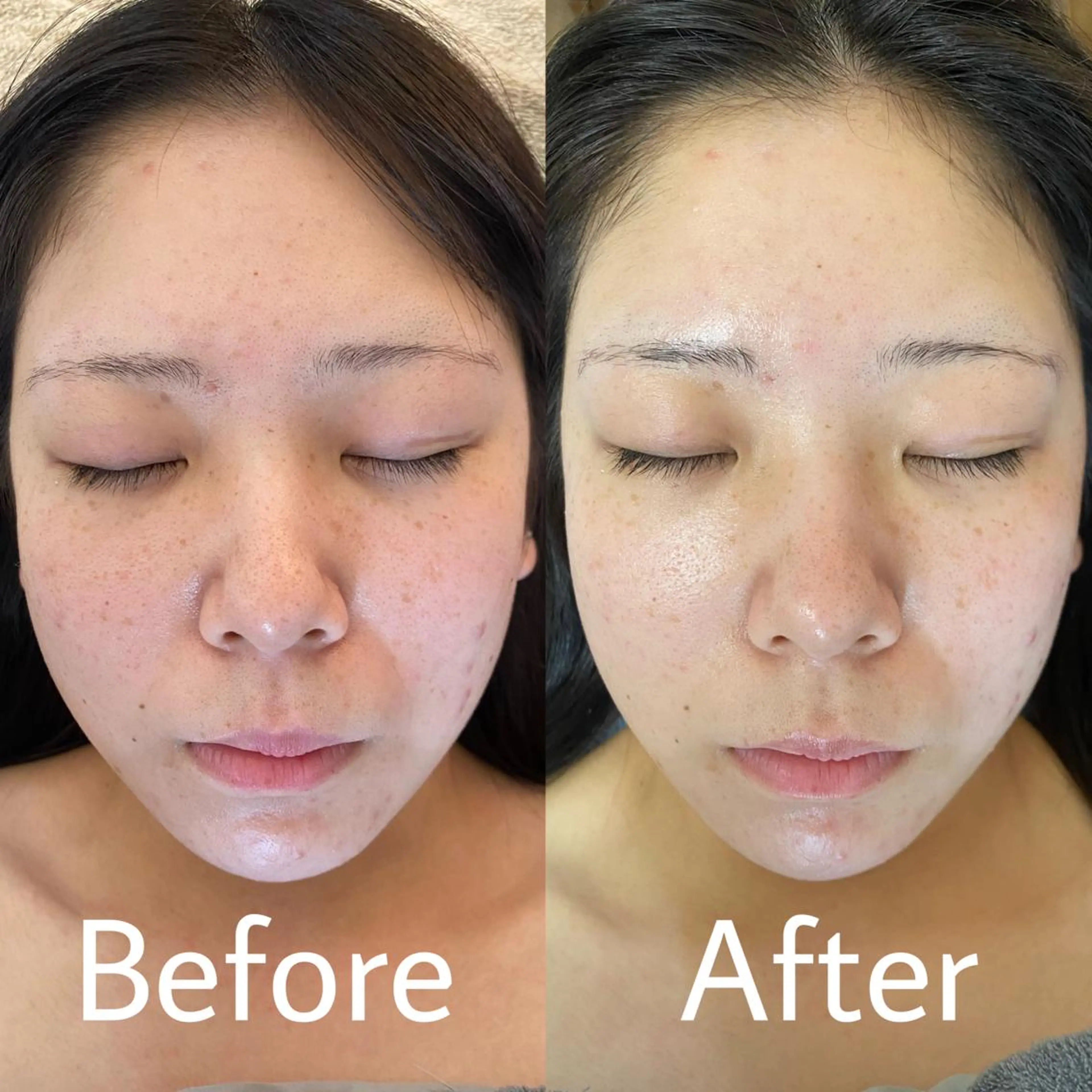 マツエク・マツパ Lily 【yurie】のマツエク・マツパデザイン