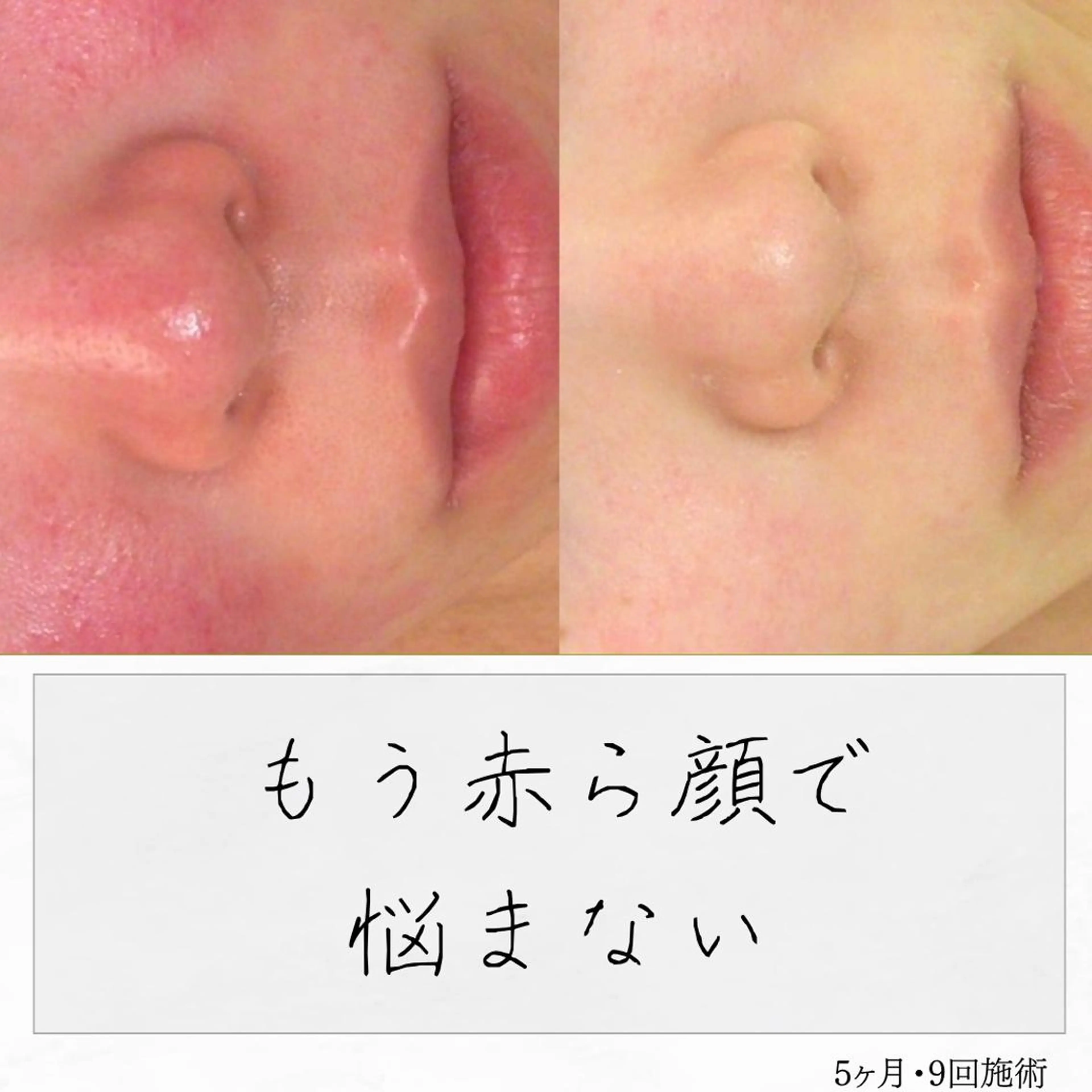 ニキビ経験者が施術 する専門サロン🌻のエステ・リラクイメージ