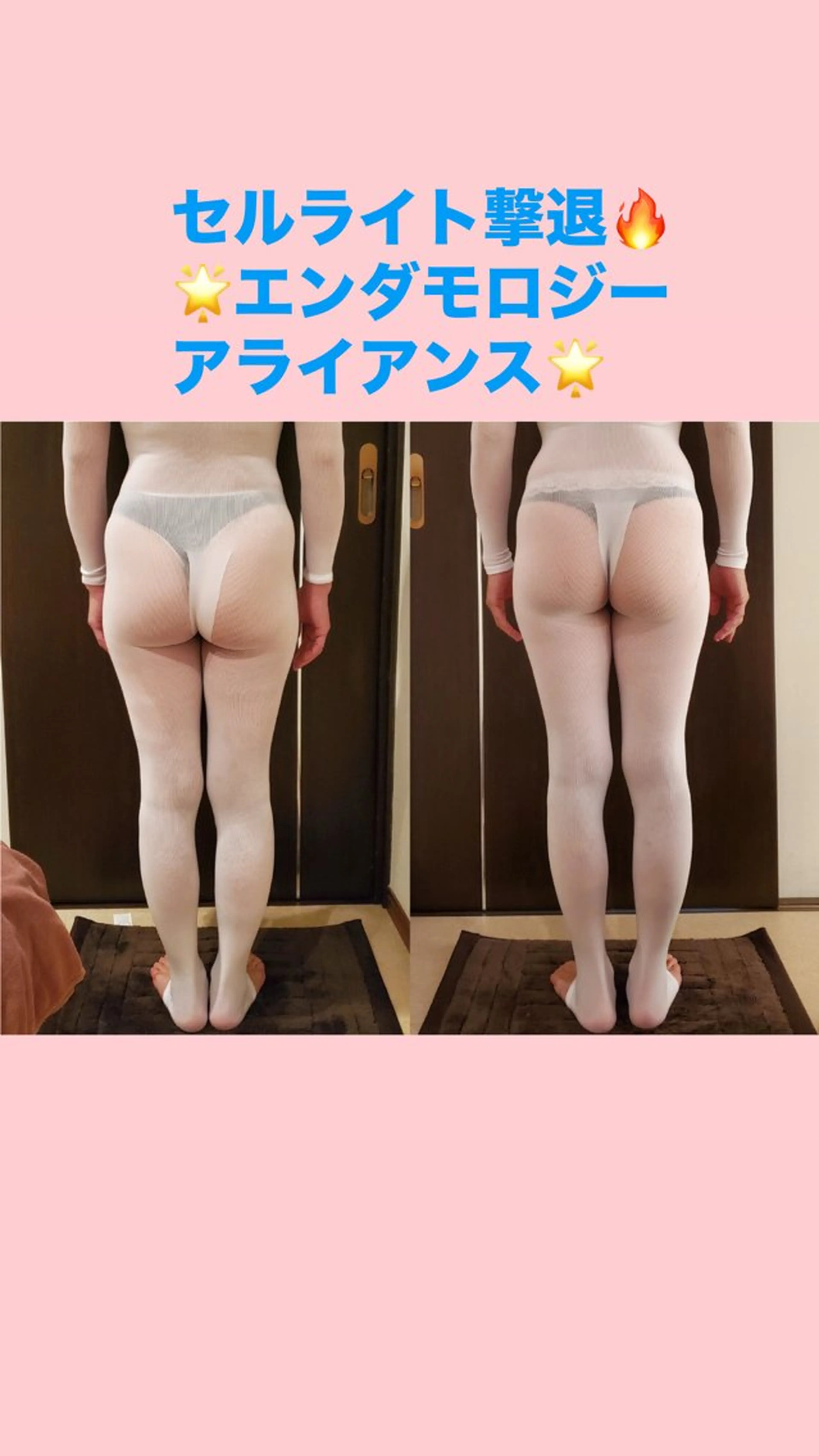 ボディアライアンス　定価¥24200の写真