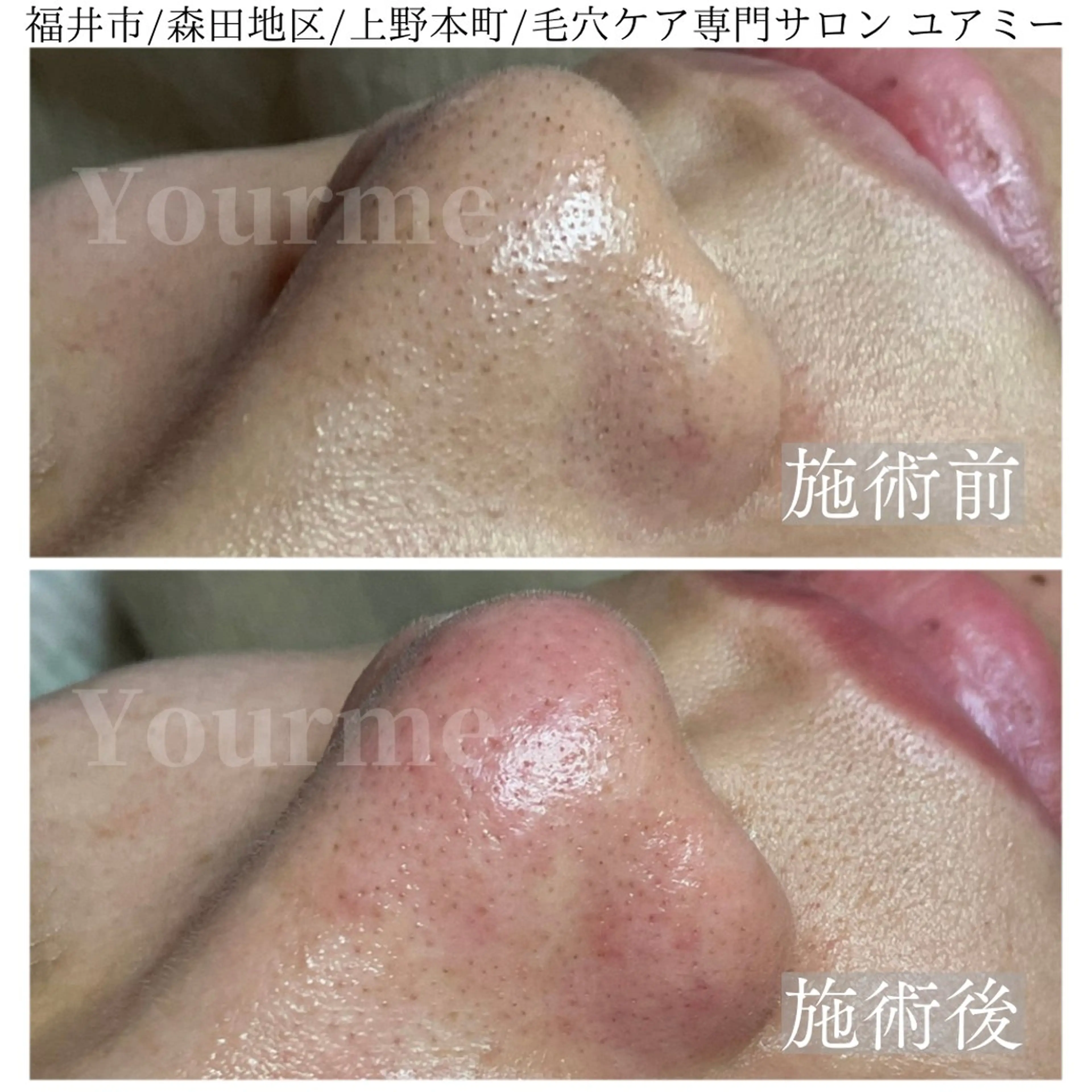 毛穴肌質ケアサロン Yourmeユアミーのエステ・リラクイメージ