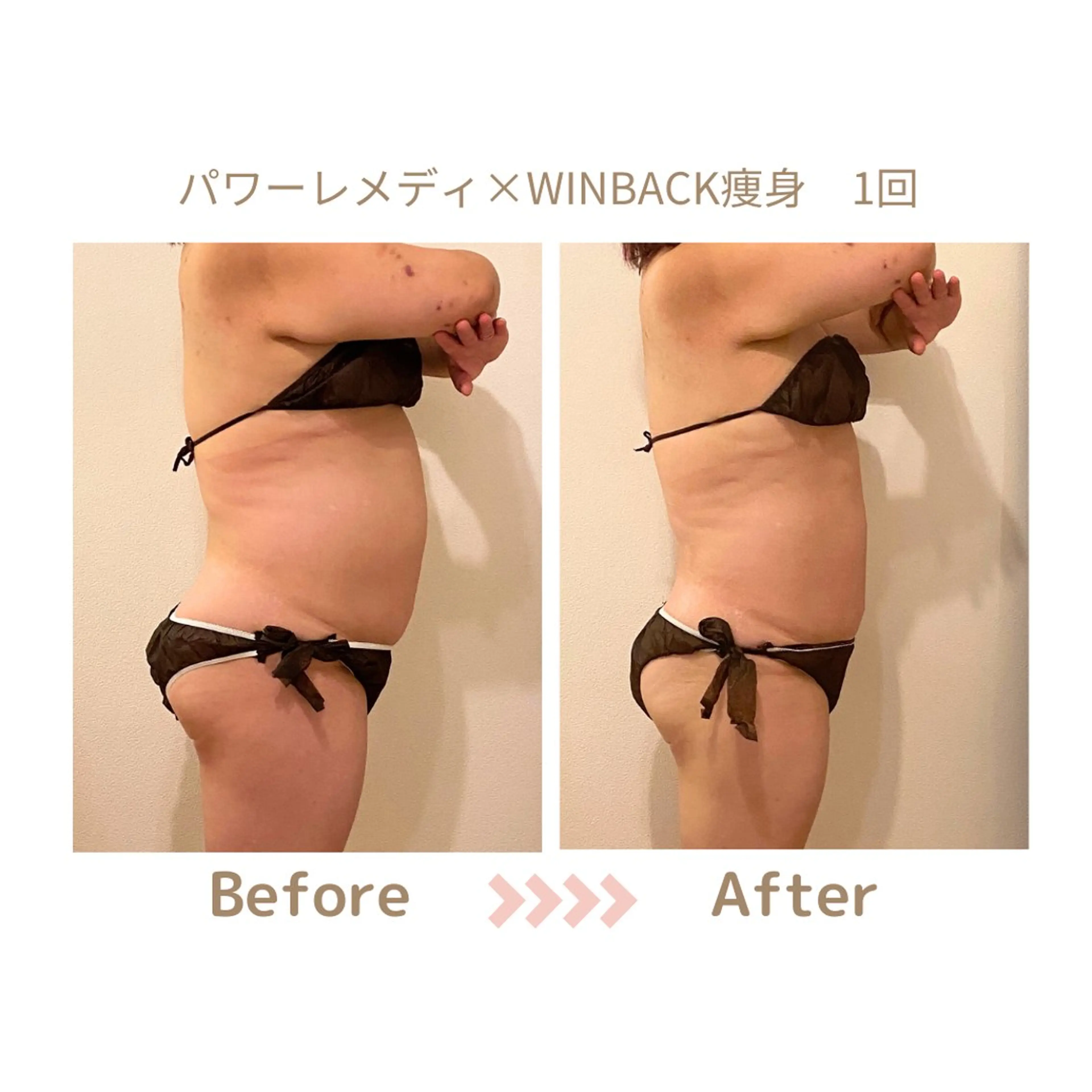 肌質改善×小顔サロン リトリト垣内のエステ・リラクイメージ