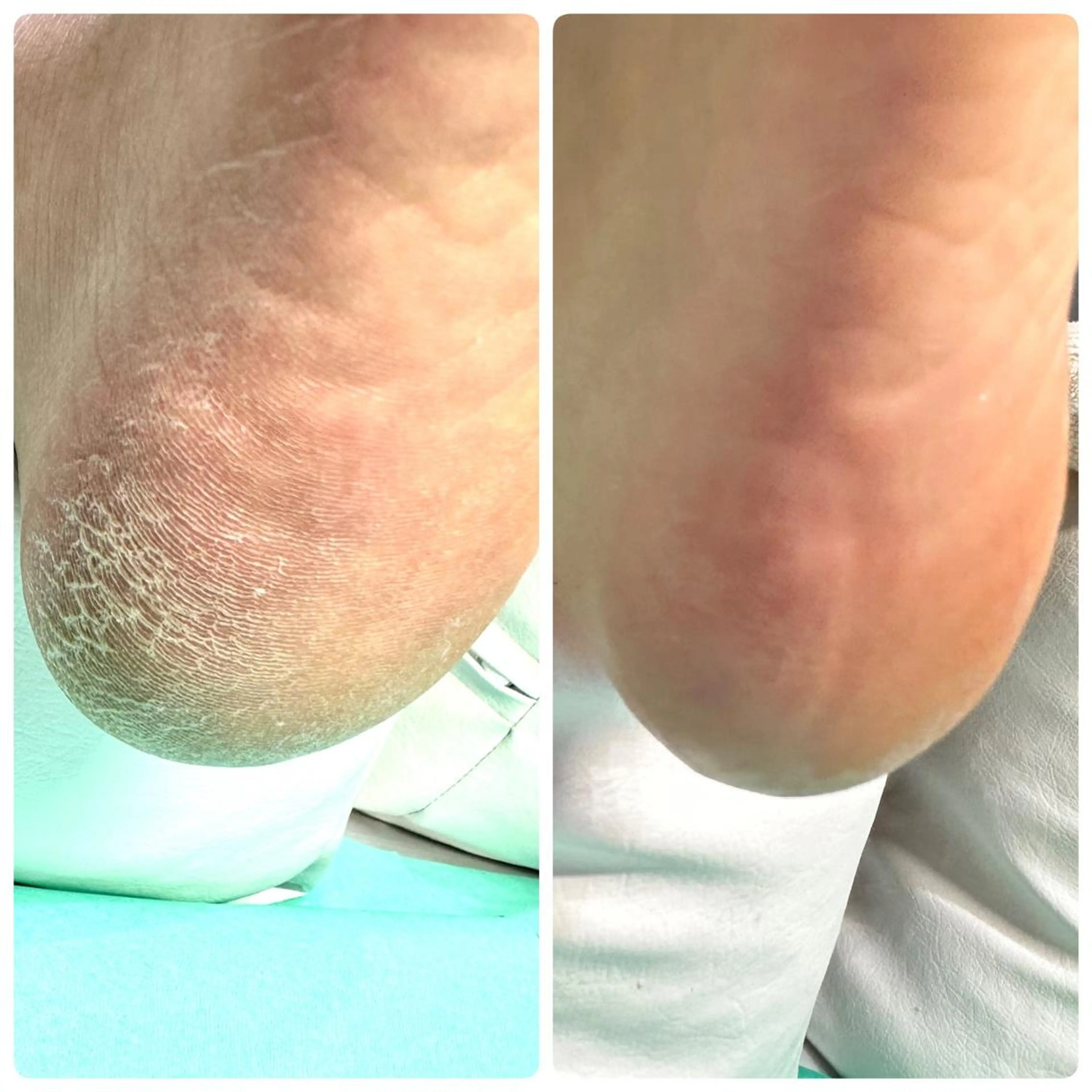 東京巻き爪 アカデミーのエステ・リラクイメージ