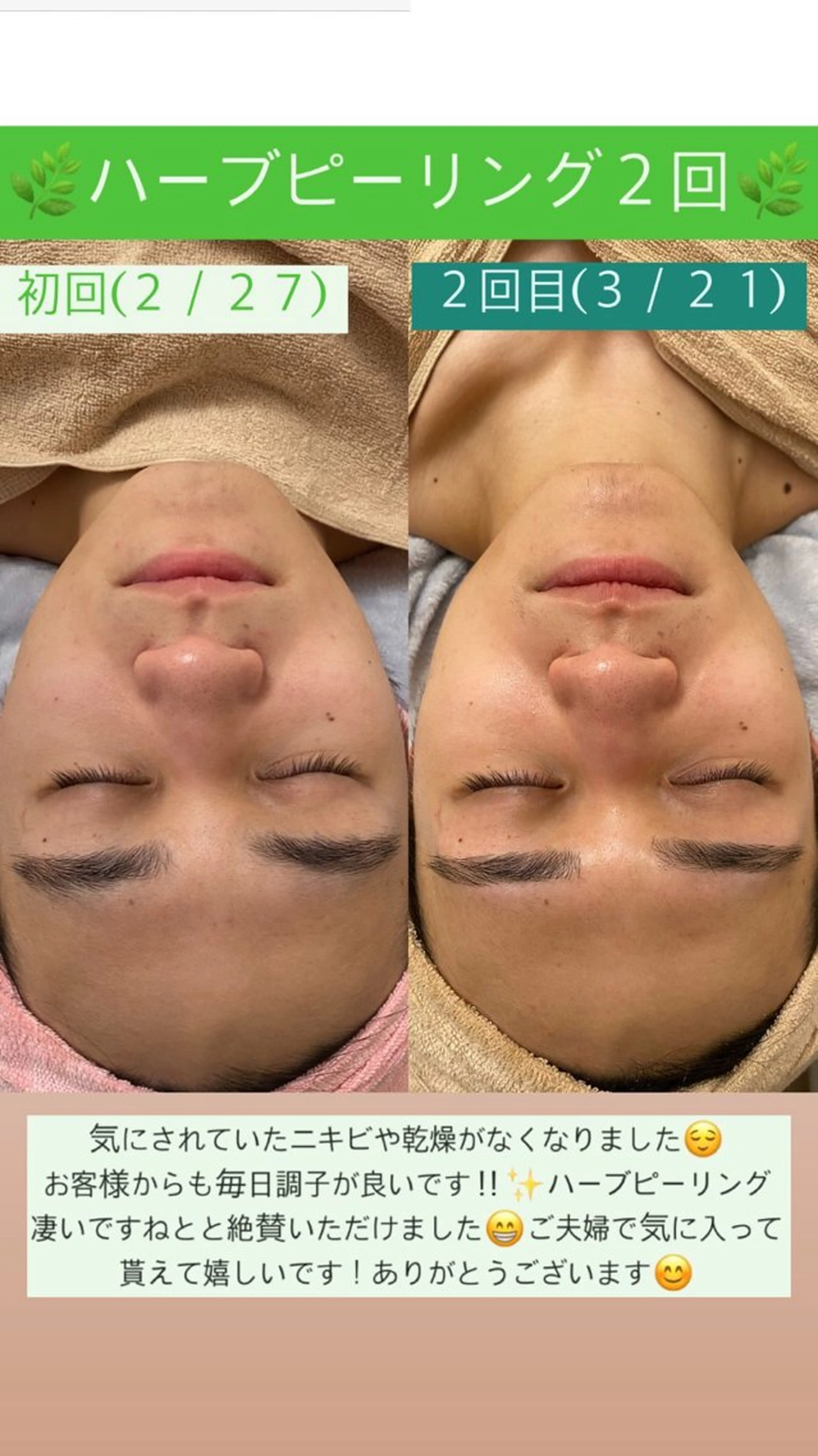 メンズ エステ Salon de Lino 御器所のエステ・リラクイメージ