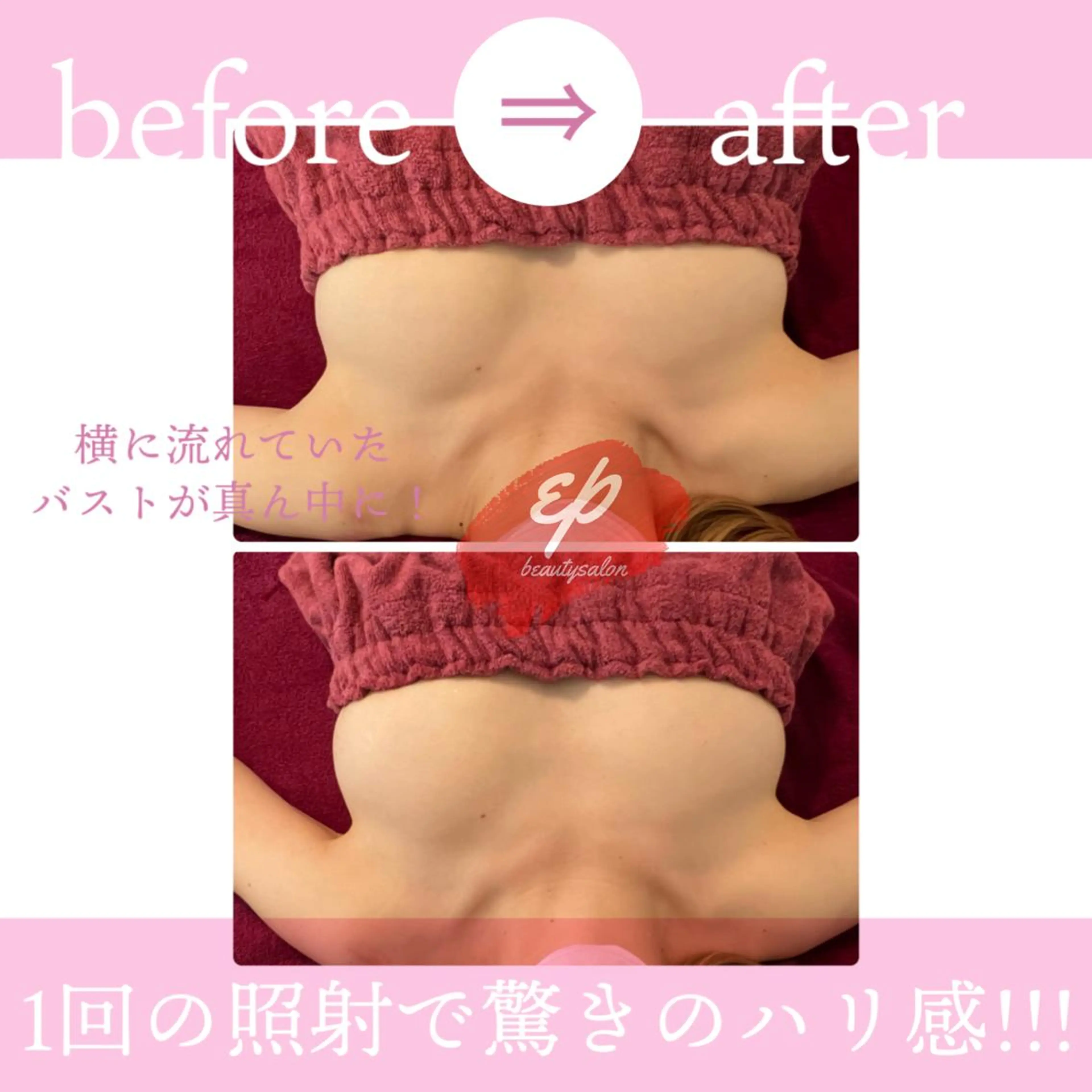 究極のバストケア💐💕ふわふわましゅまるおっぱいに✨️ナイーブなお悩みなのでまずは無料カウンセリングへお越しください。の写真