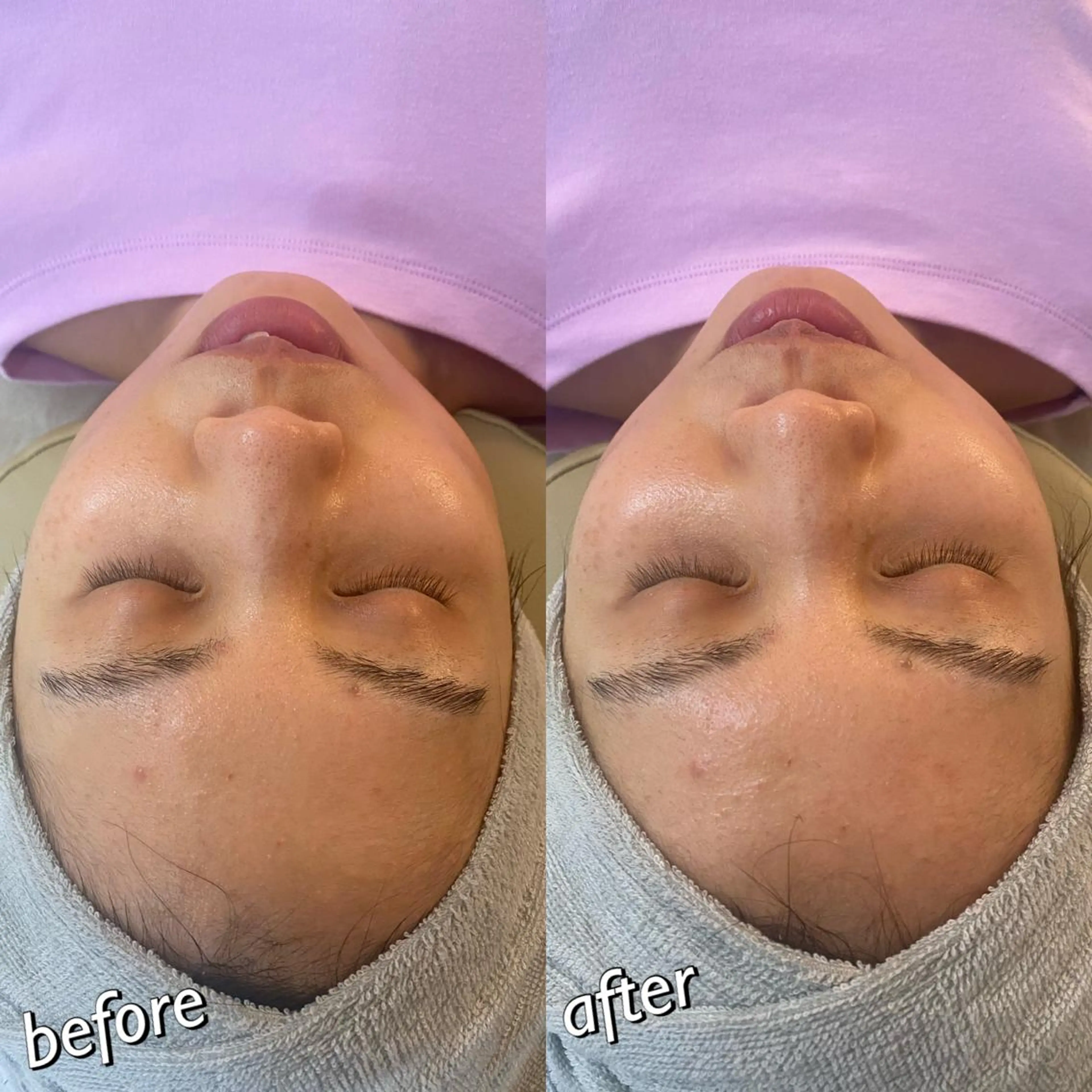 うなじ脱毛/美肌脱毛 LABELのエステ・リラクイメージ