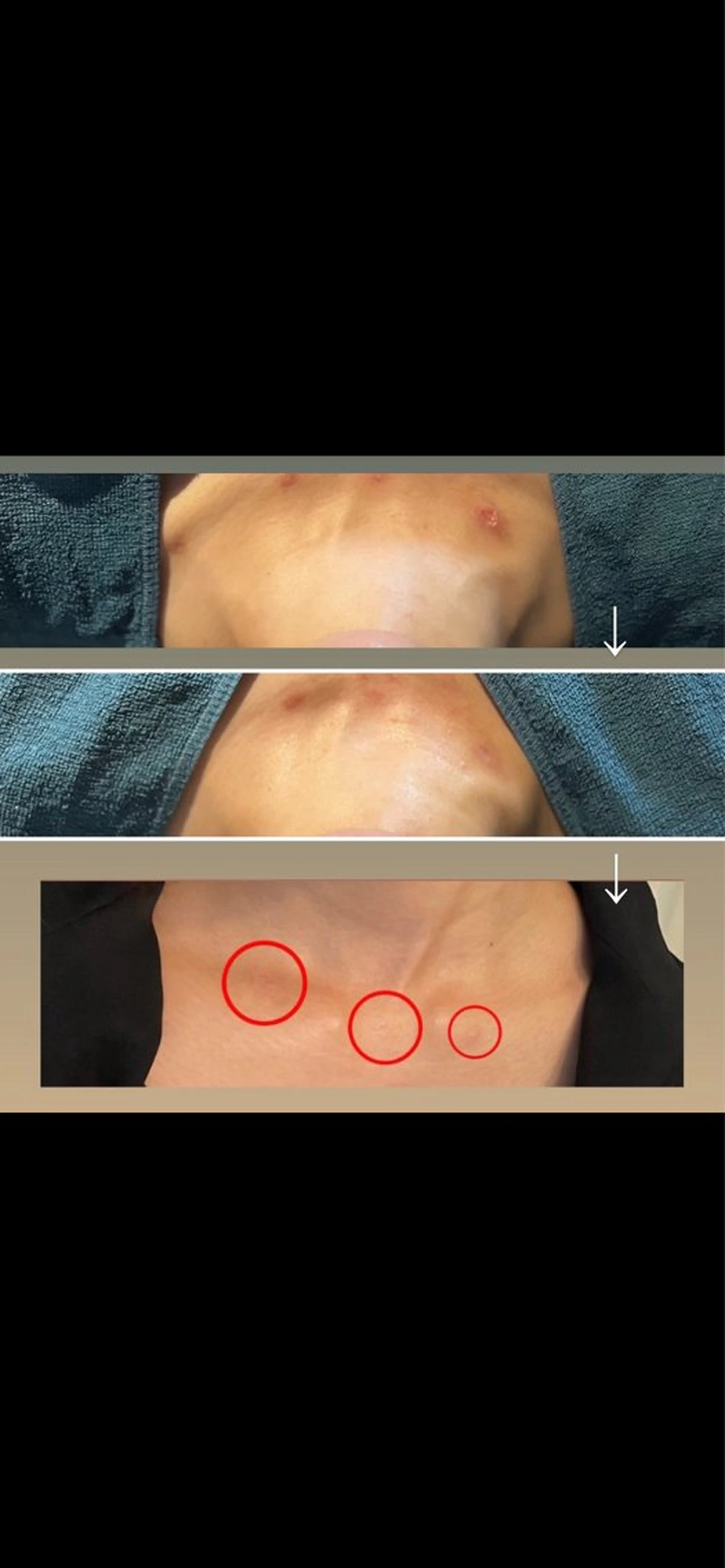 ニキビ/疲労回復ケア シェソワのエステ・リラクイメージ