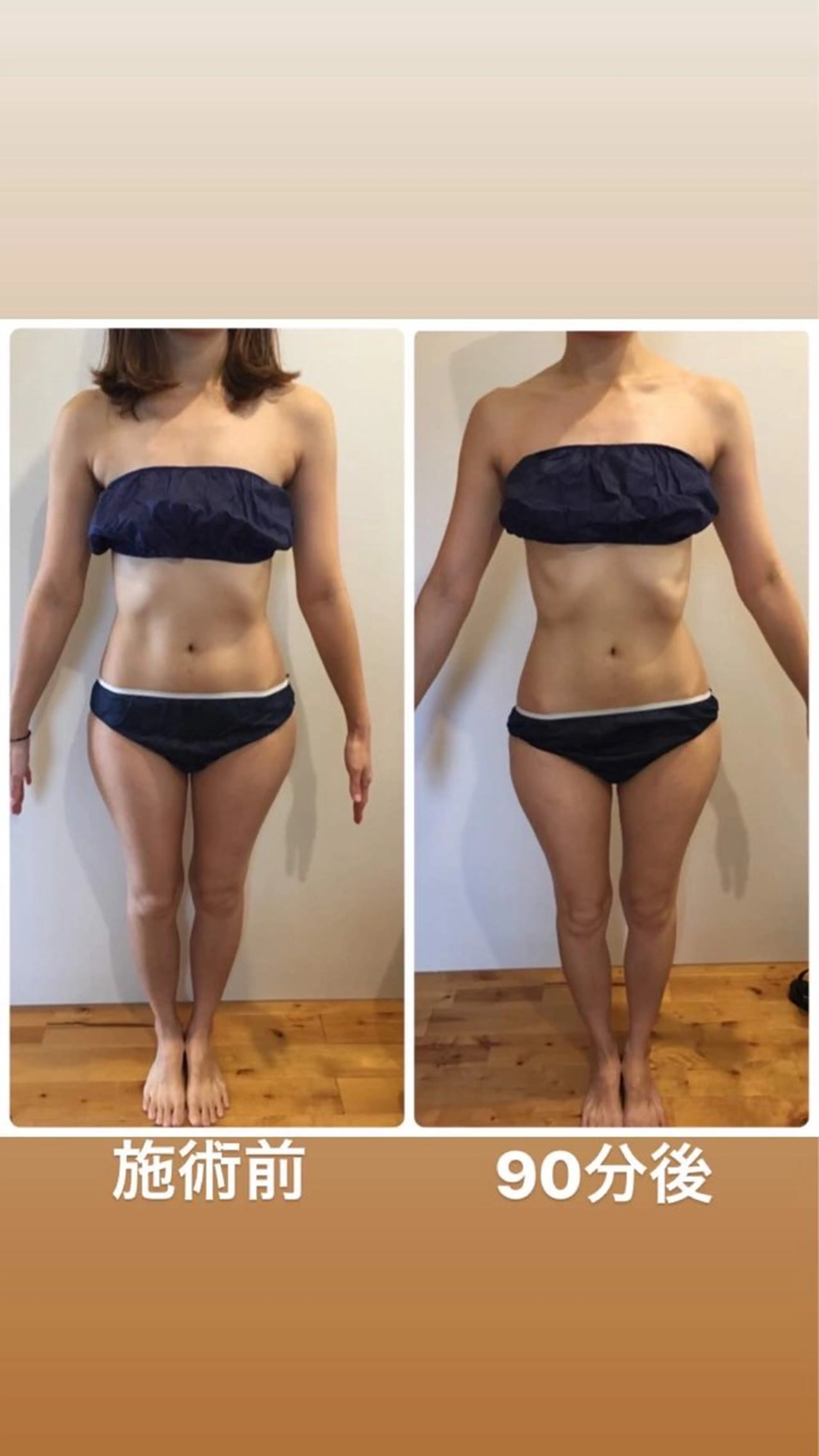 つるんとむき卵肌に 🌟ハーブピーリングのエステ・リラクイメージ