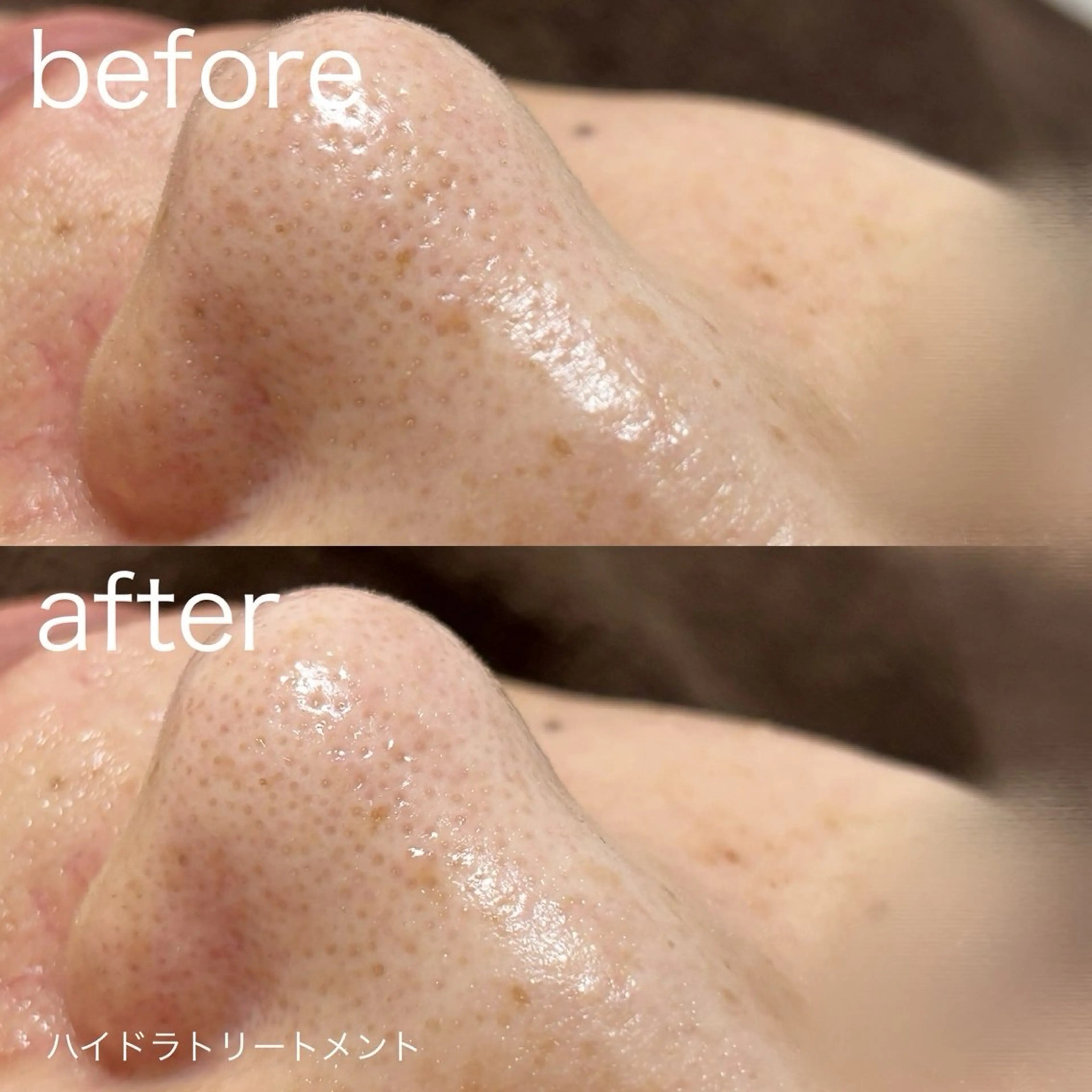 その他 lulularico Yuのエステ・リラクイメージ