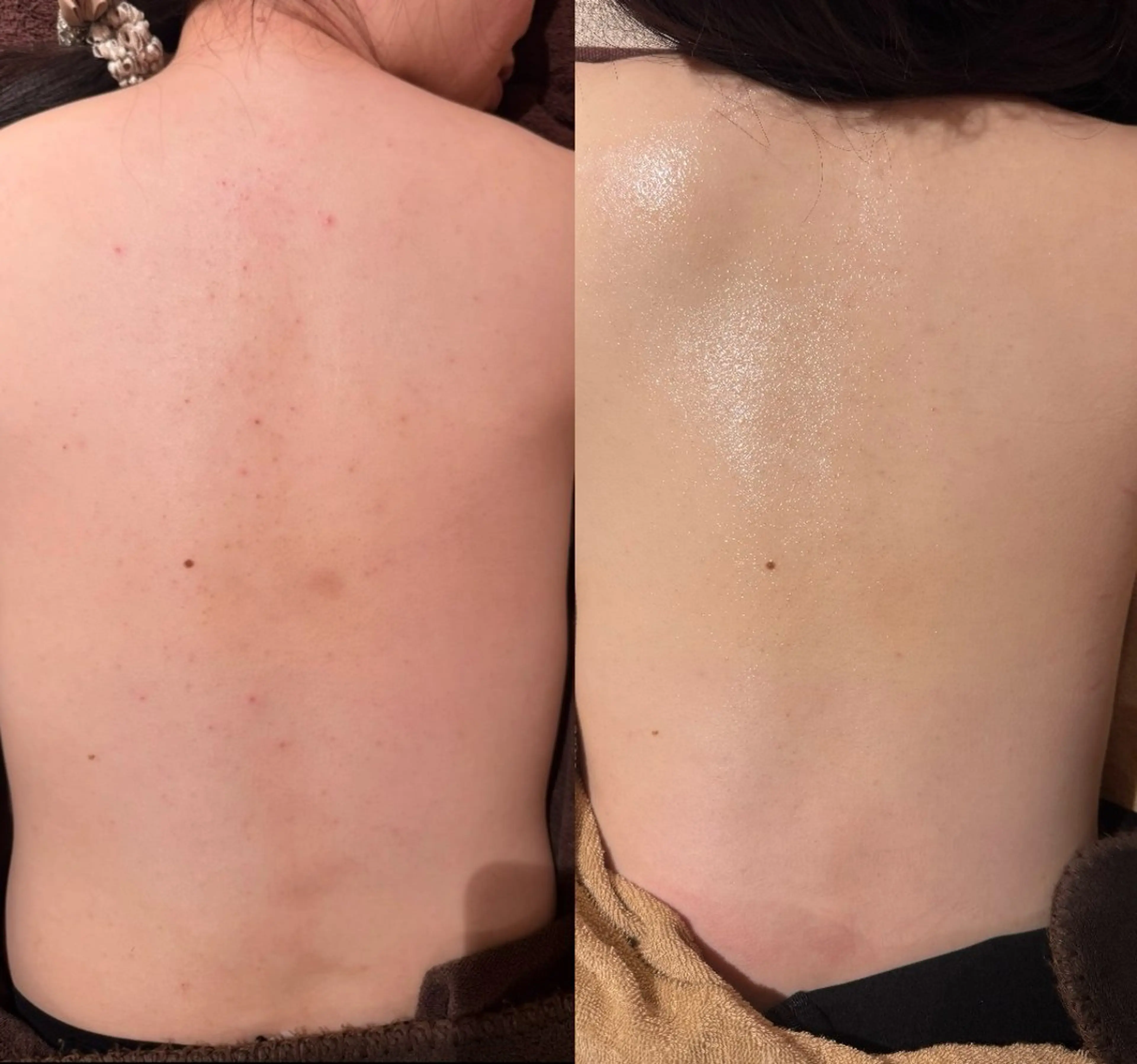 エステ 森 美優のエステ・リラクイメージ