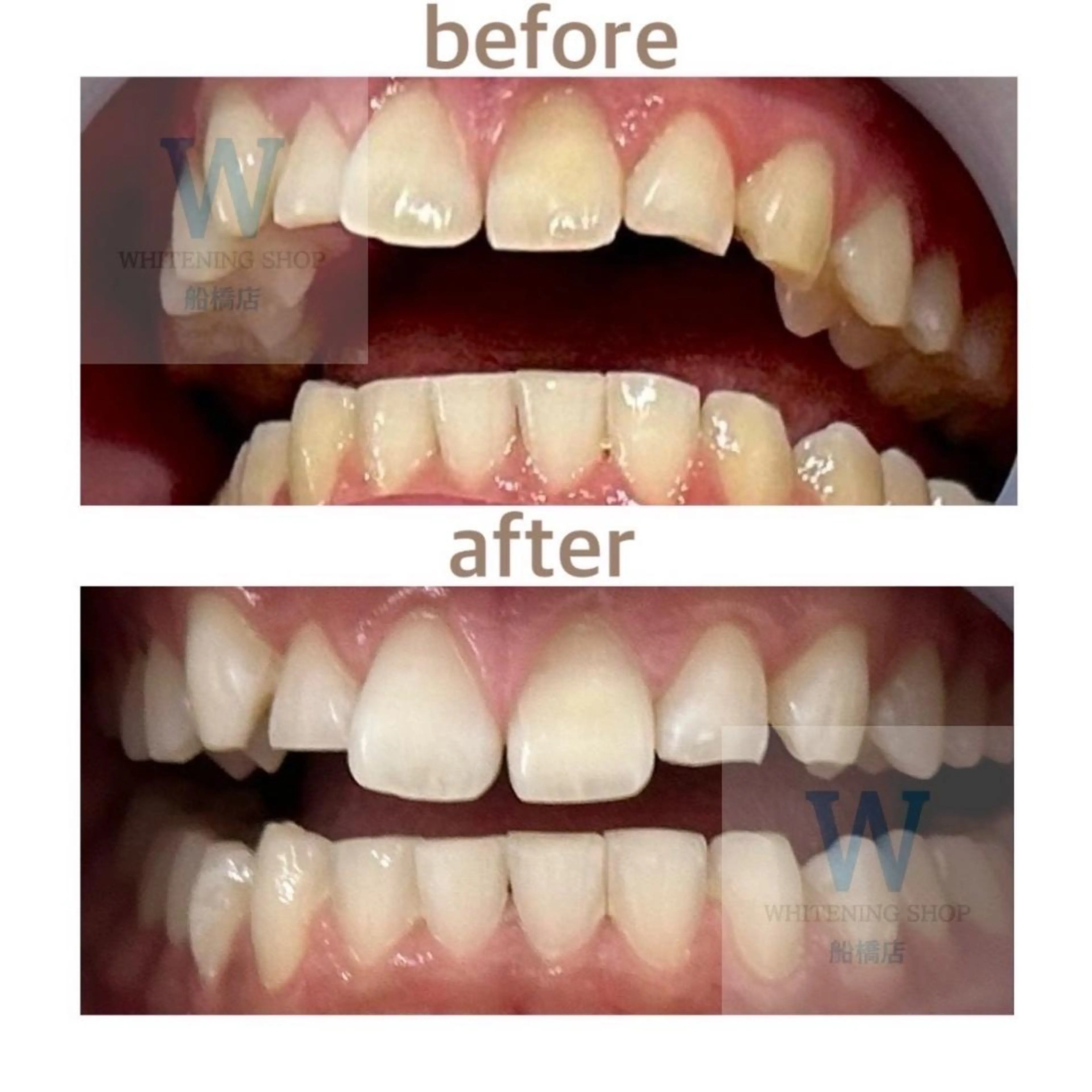 エステ リラク ホワイトニング ショップ船橋店🦷のエステ・リラクイメージ