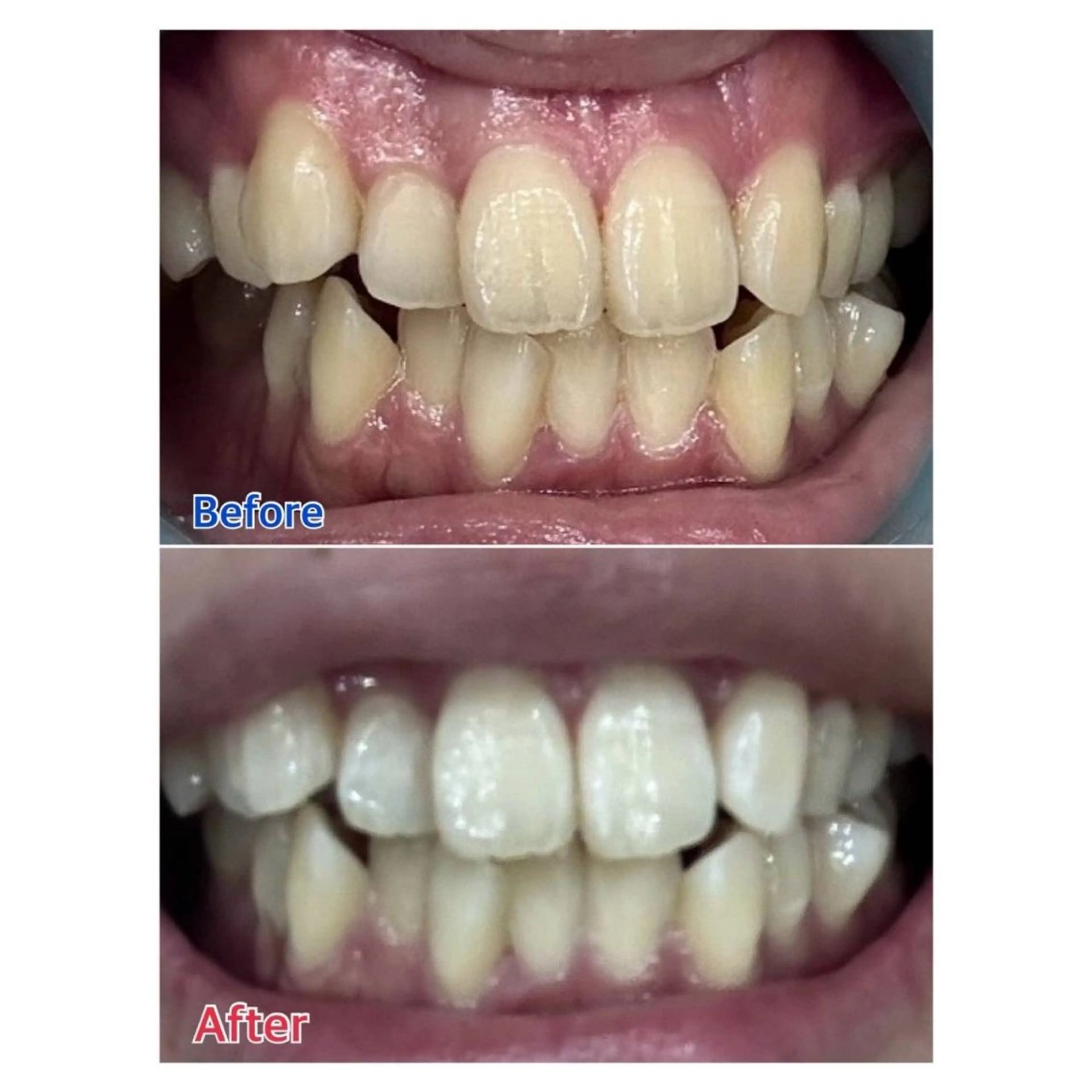 Melty 輝のその他イメージ