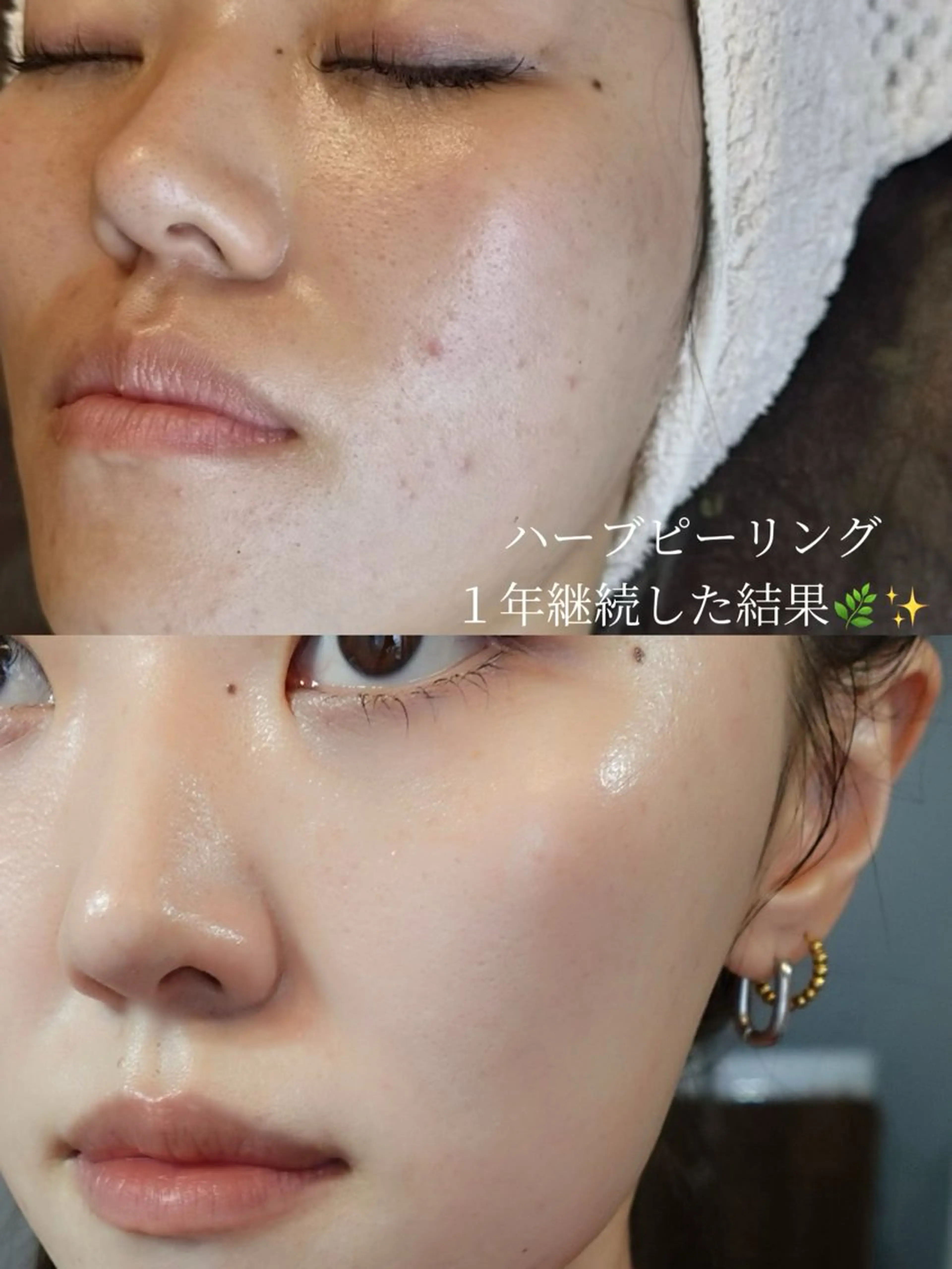 エステ リラク 艶肌デトックス🫧 Samiraのエステ・リラクイメージ