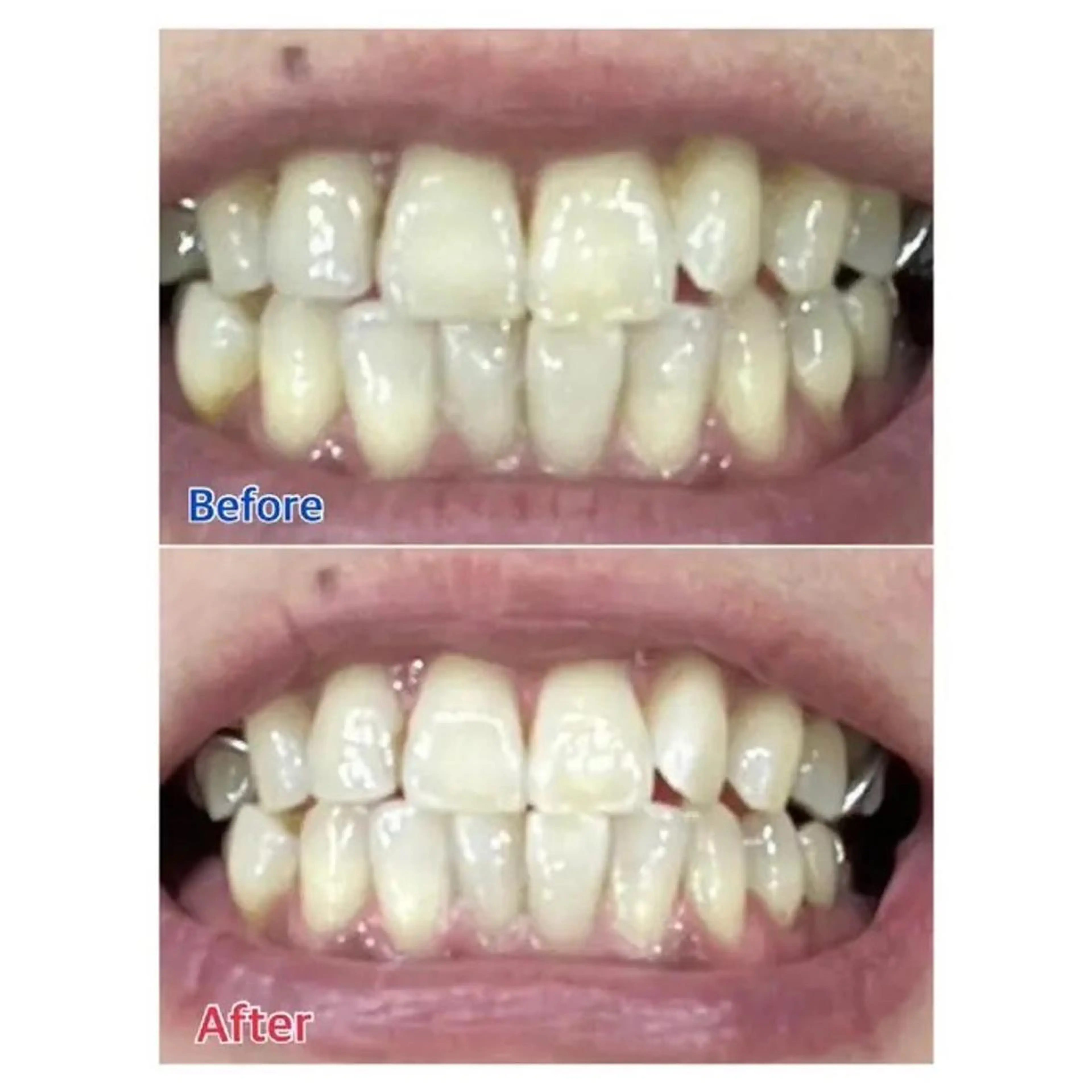 M渋谷 ホワイトニングのその他イメージ