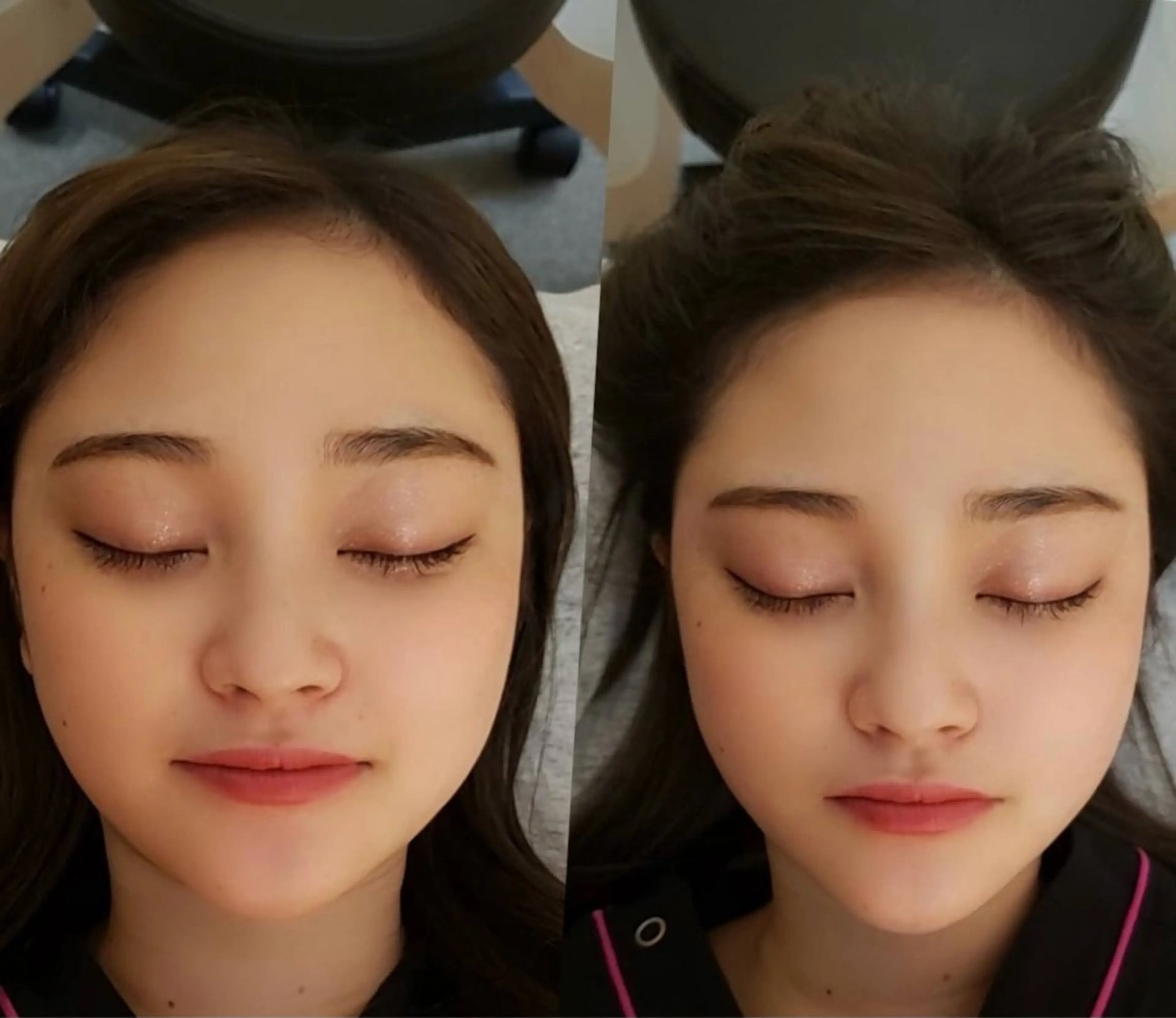 【美容鍼×小顔矯正✨】すっぴん革命💎むくみゼロ小顔✨の写真