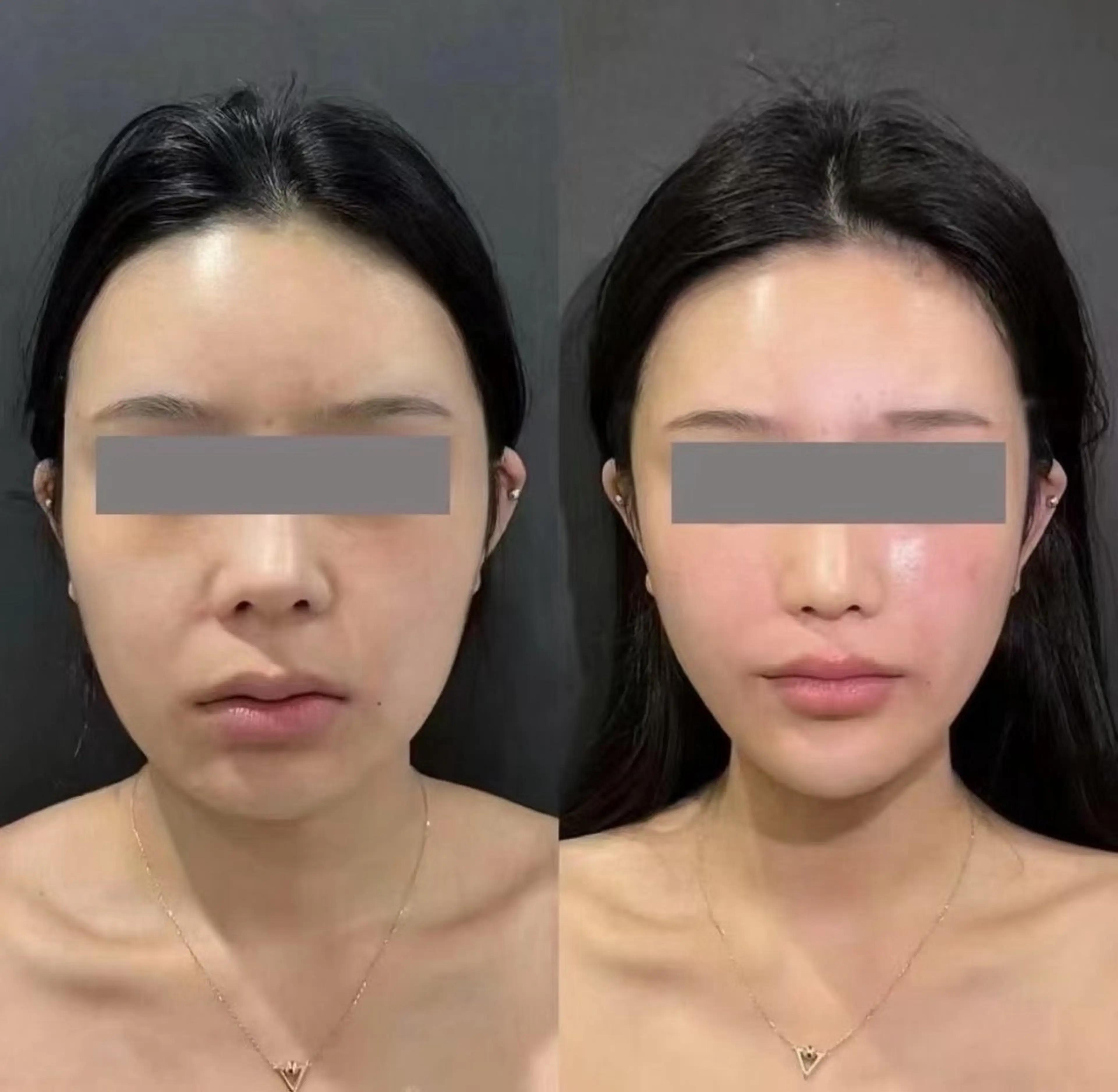 ショート aliaハーブ水光店 エステティシャン募集のエステ・リラクイメージ