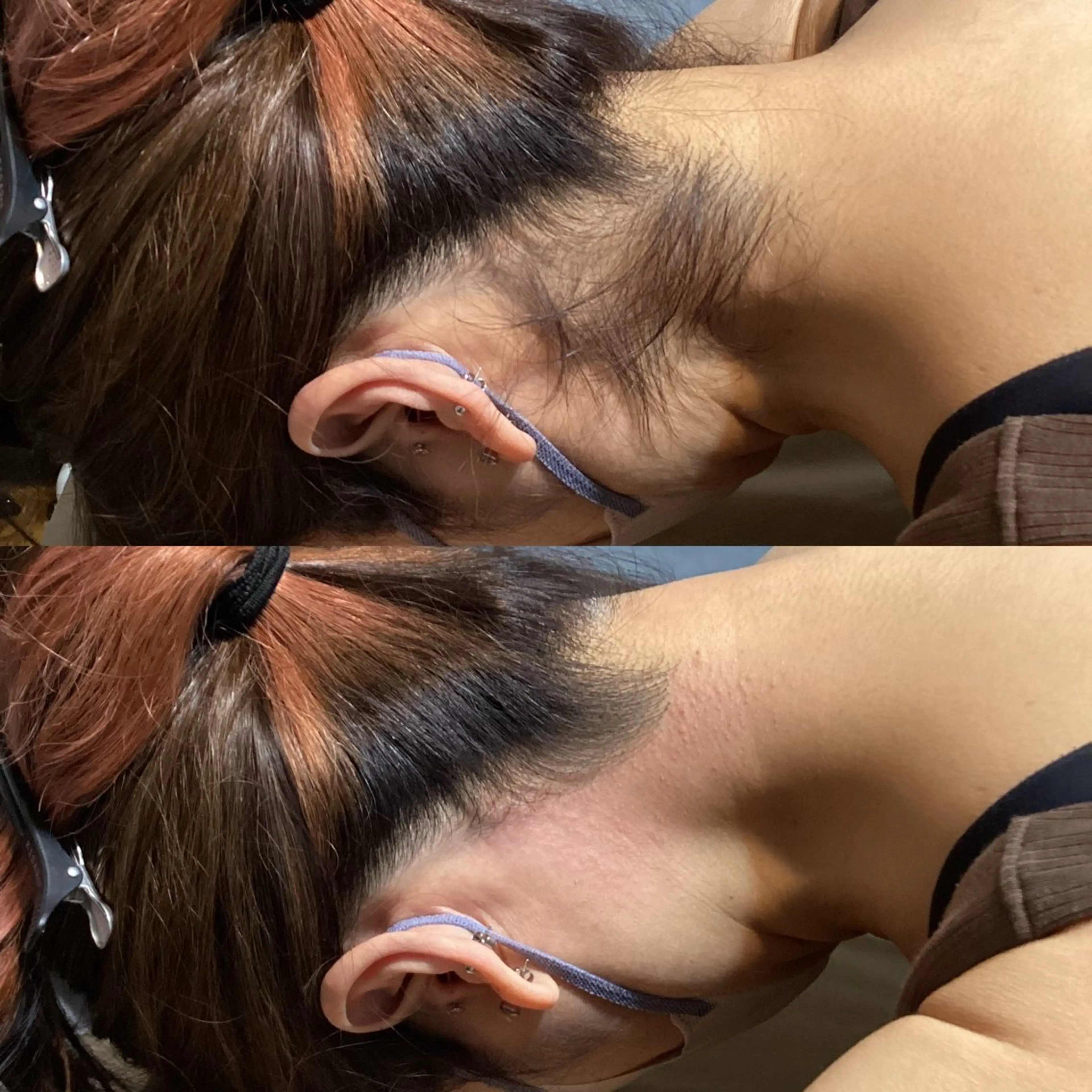 池袋脱毛 さとうのエステ・リラクイメージ