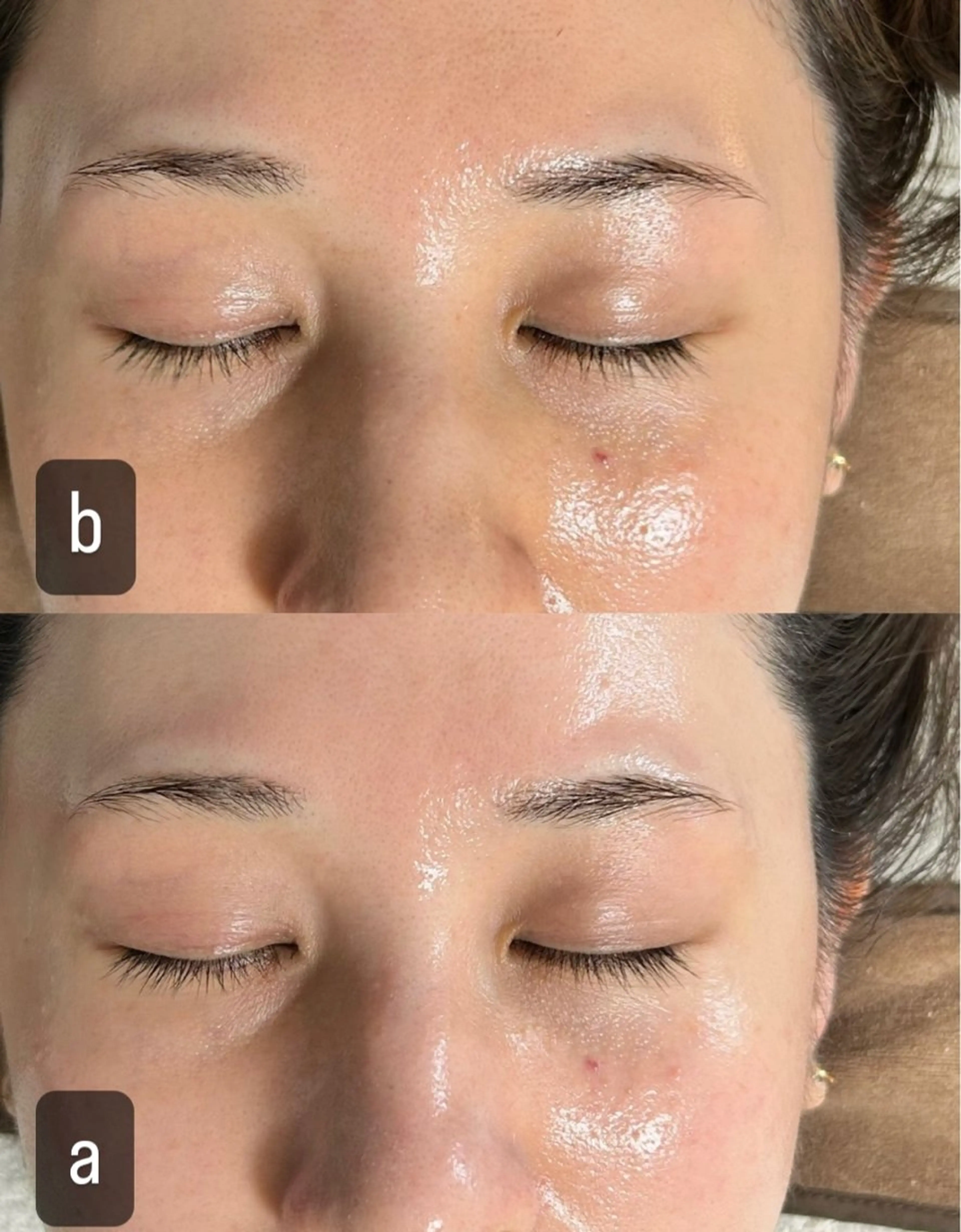 217 ホワイトニングルームのエステ・リラクイメージ