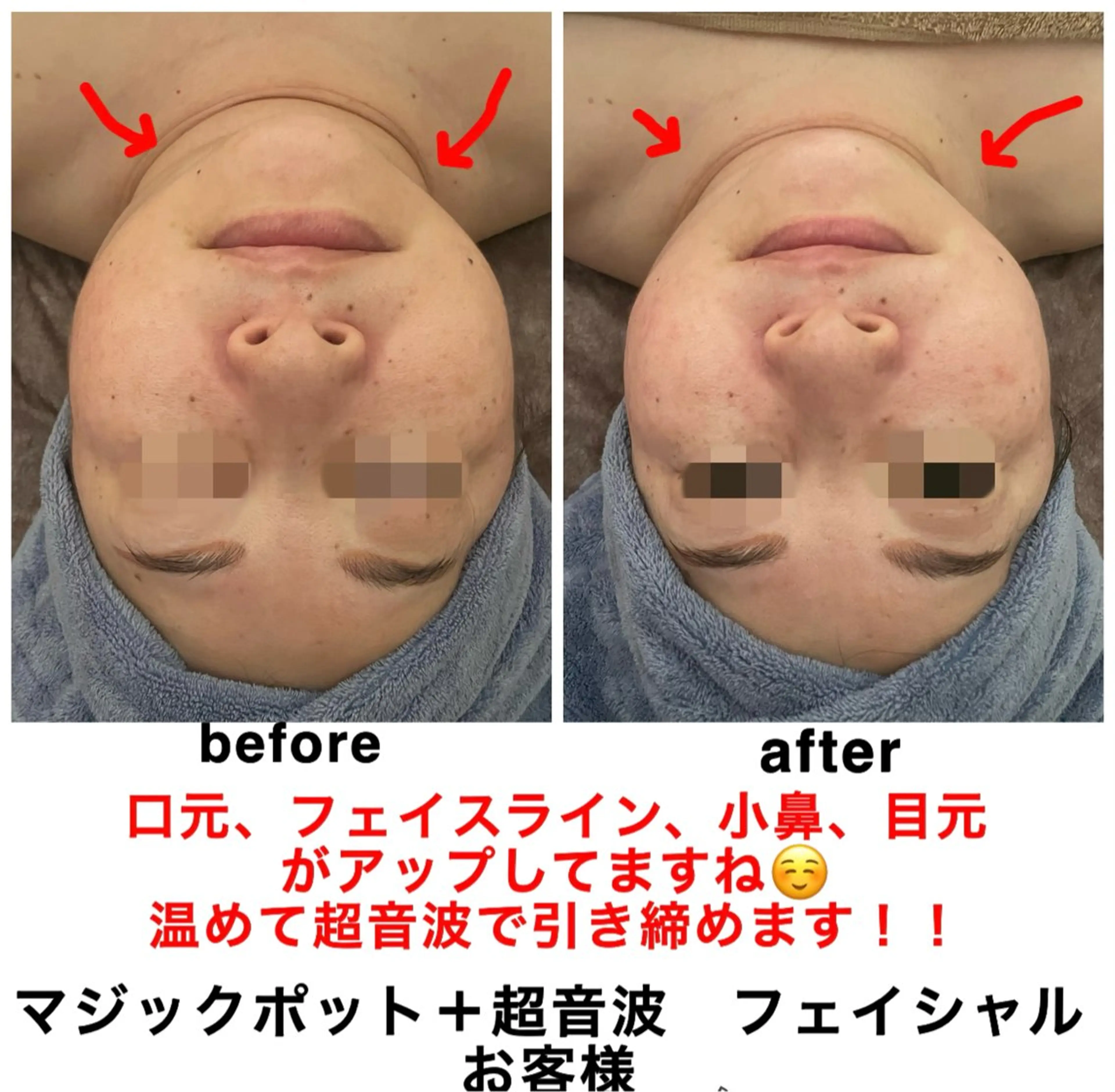 エステ リラク ネイル・エステサロン UILANIのネイルデザイン