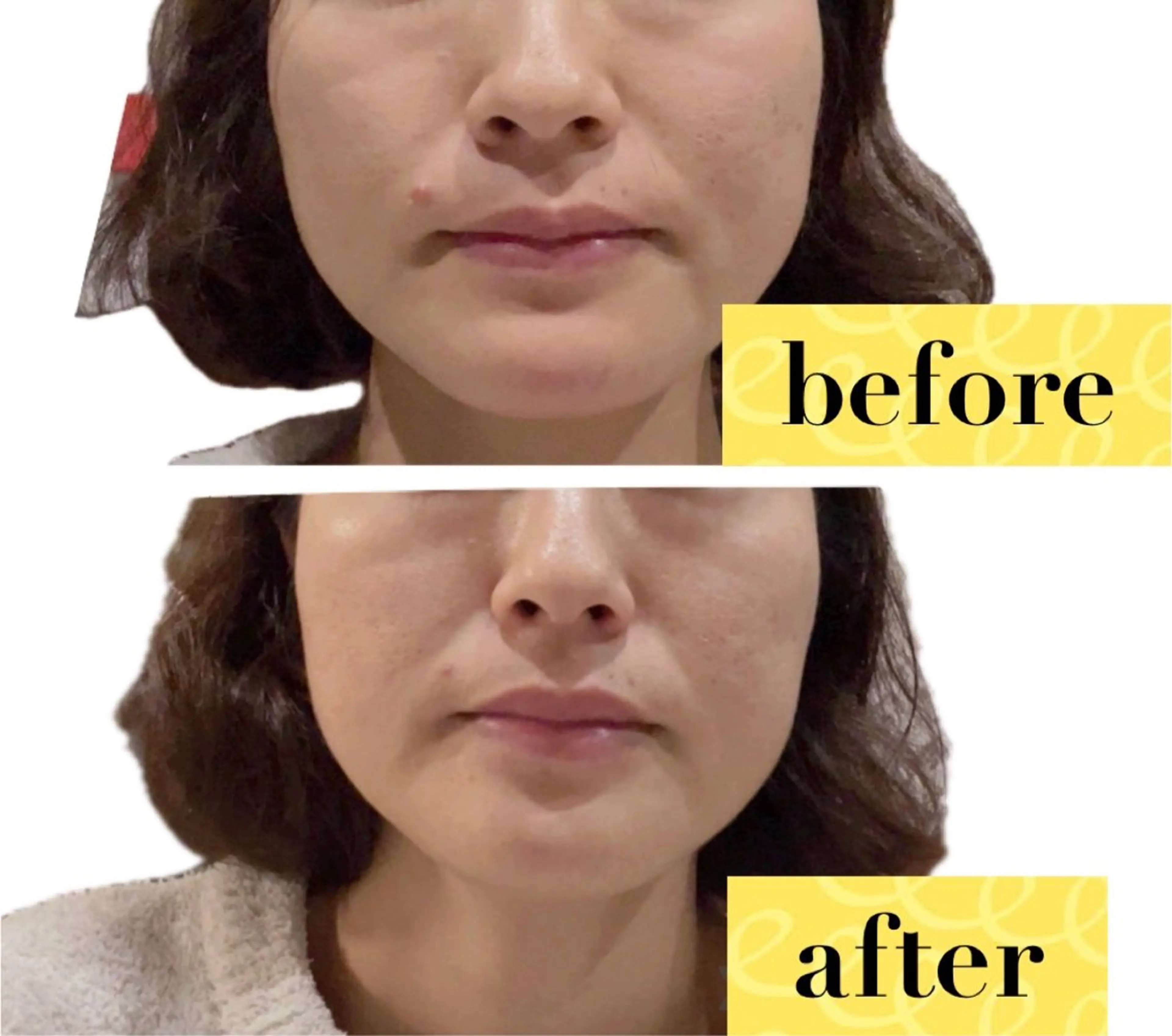 脱毛・美肌サロン LILIAN 脱石油のエステ・リラクイメージ