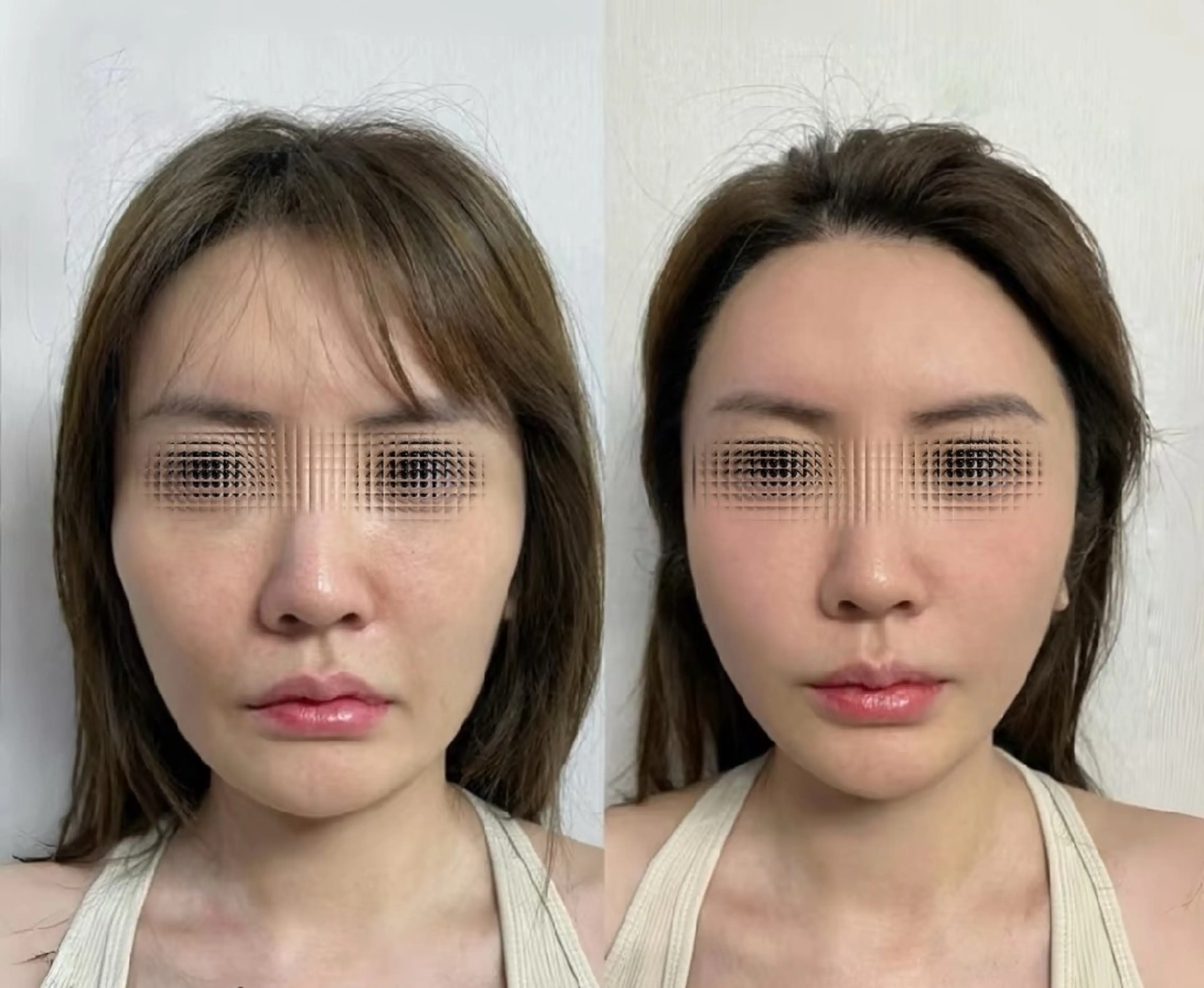 アイブロウ 眉毛ワックス脱毛 aliaハイフ&水光ジェットサロン所属・aliaハーブ水光店 エステティシャン募集のエステ・リラクイメージ