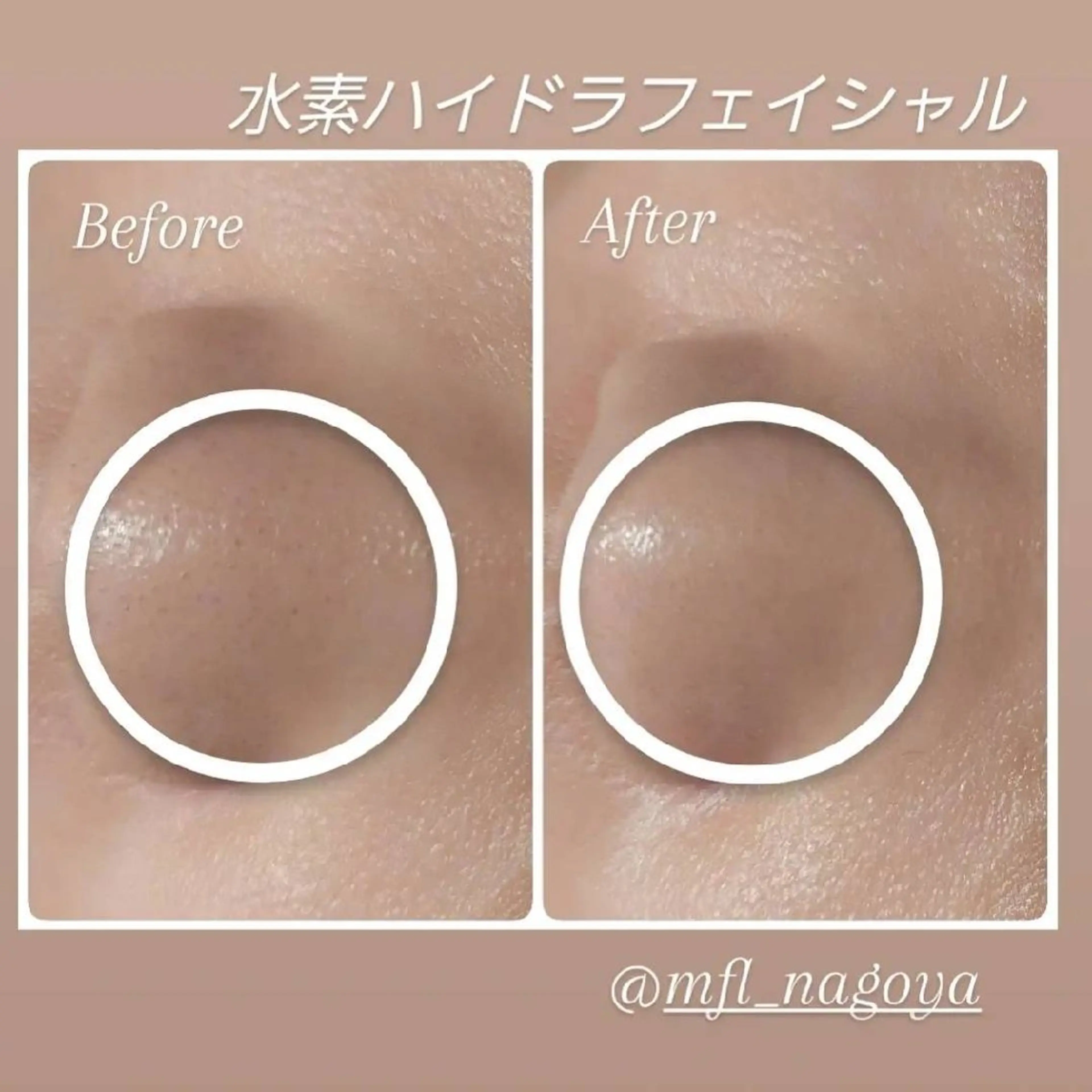 MyFairLady miuのエステ・リラクイメージ