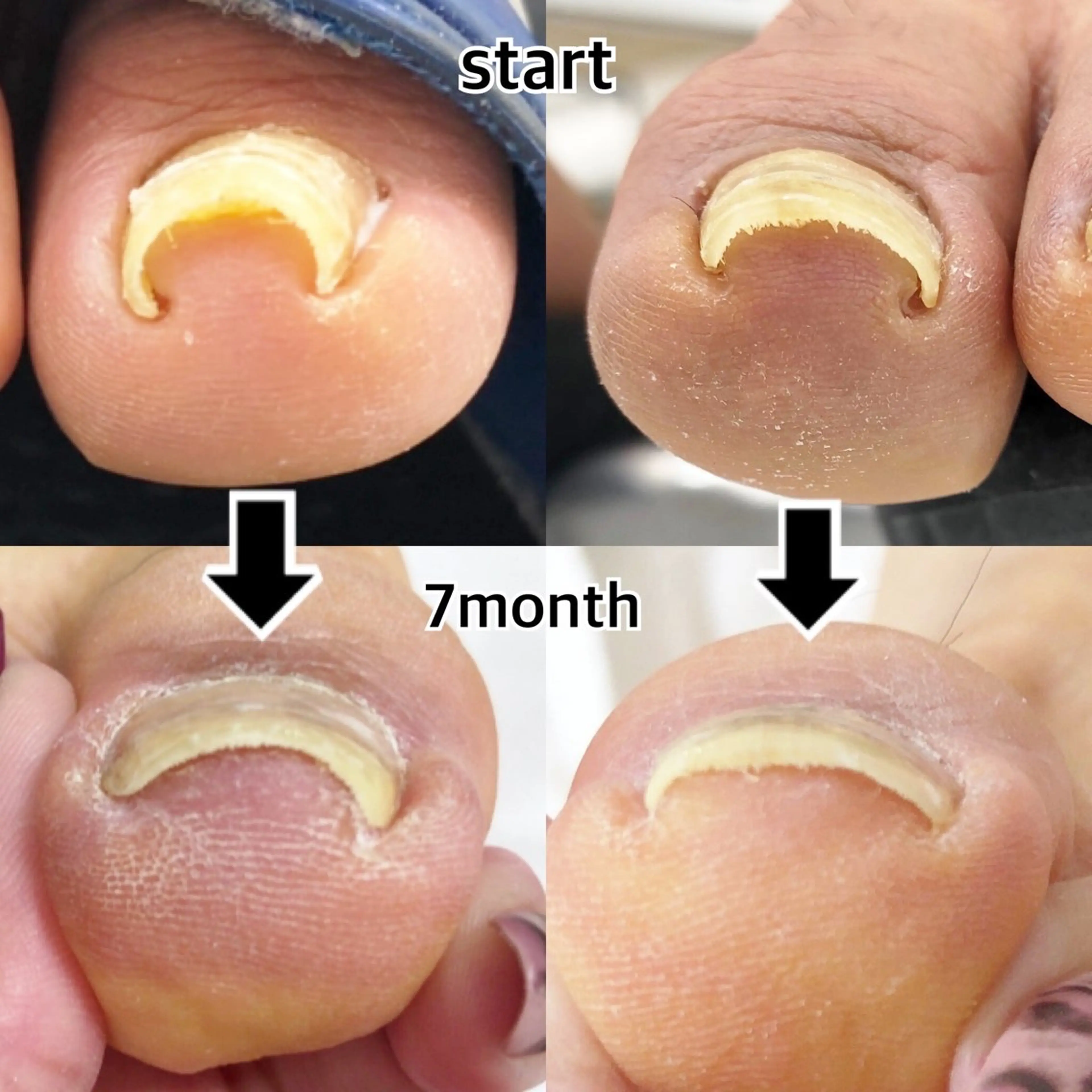 ネイル その他 atelier alle.のネイルデザイン