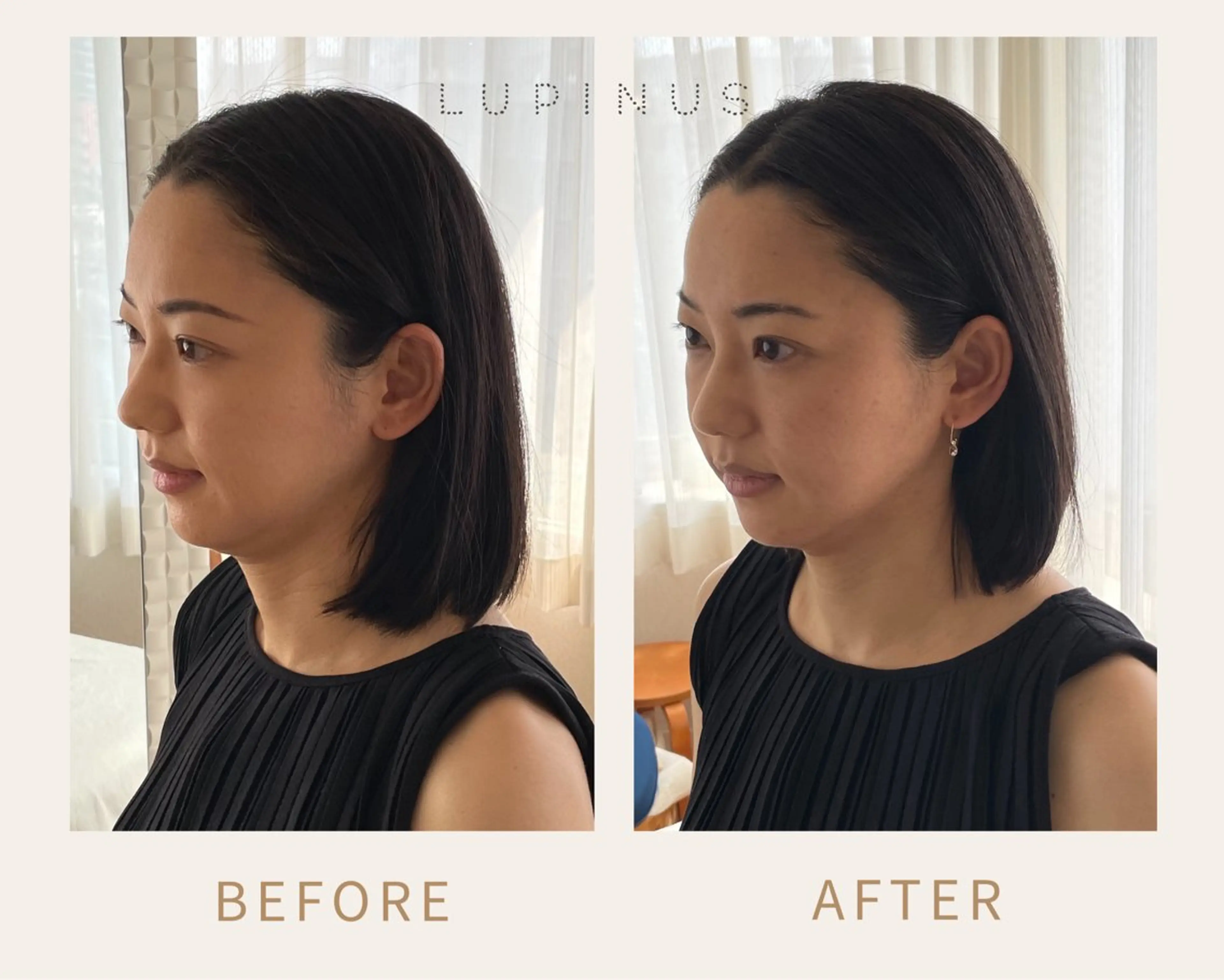 美容整体ルピナス 及川ゆりかのエステ・リラクイメージ