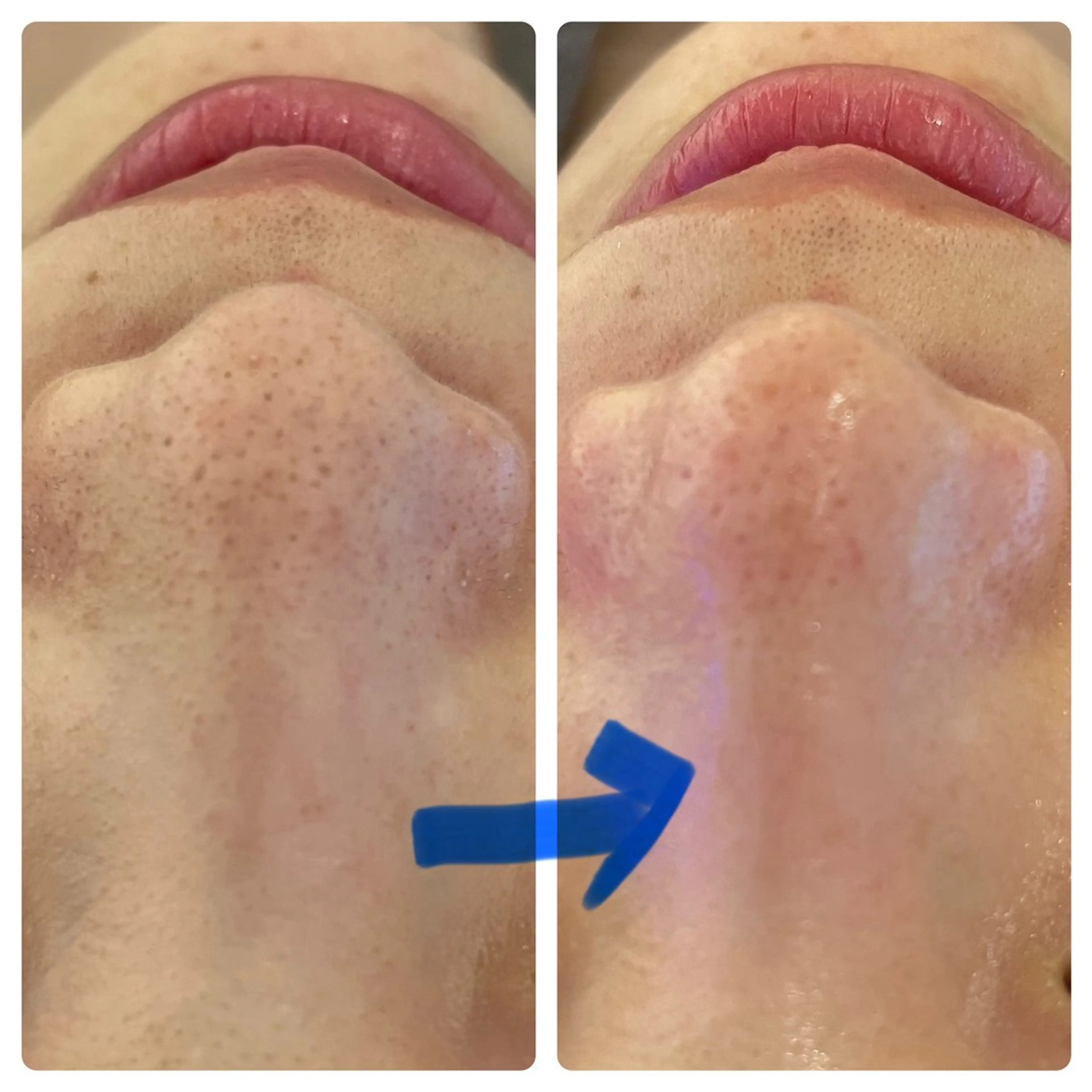 エステ Blue Moon 【ブルームーン】のエステ・リラクイメージ