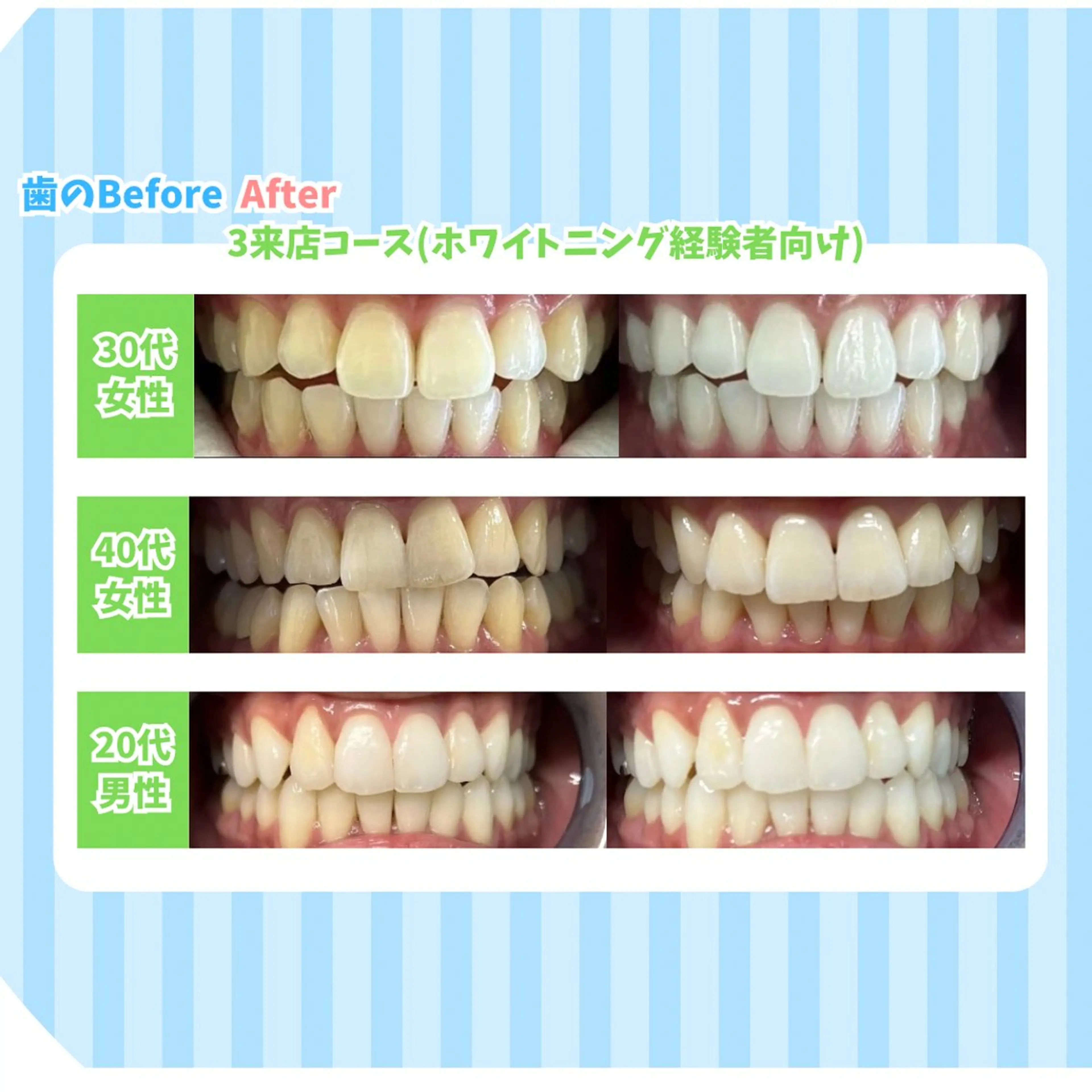 セルフホワイトニング Dolce水戸店のその他イメージ